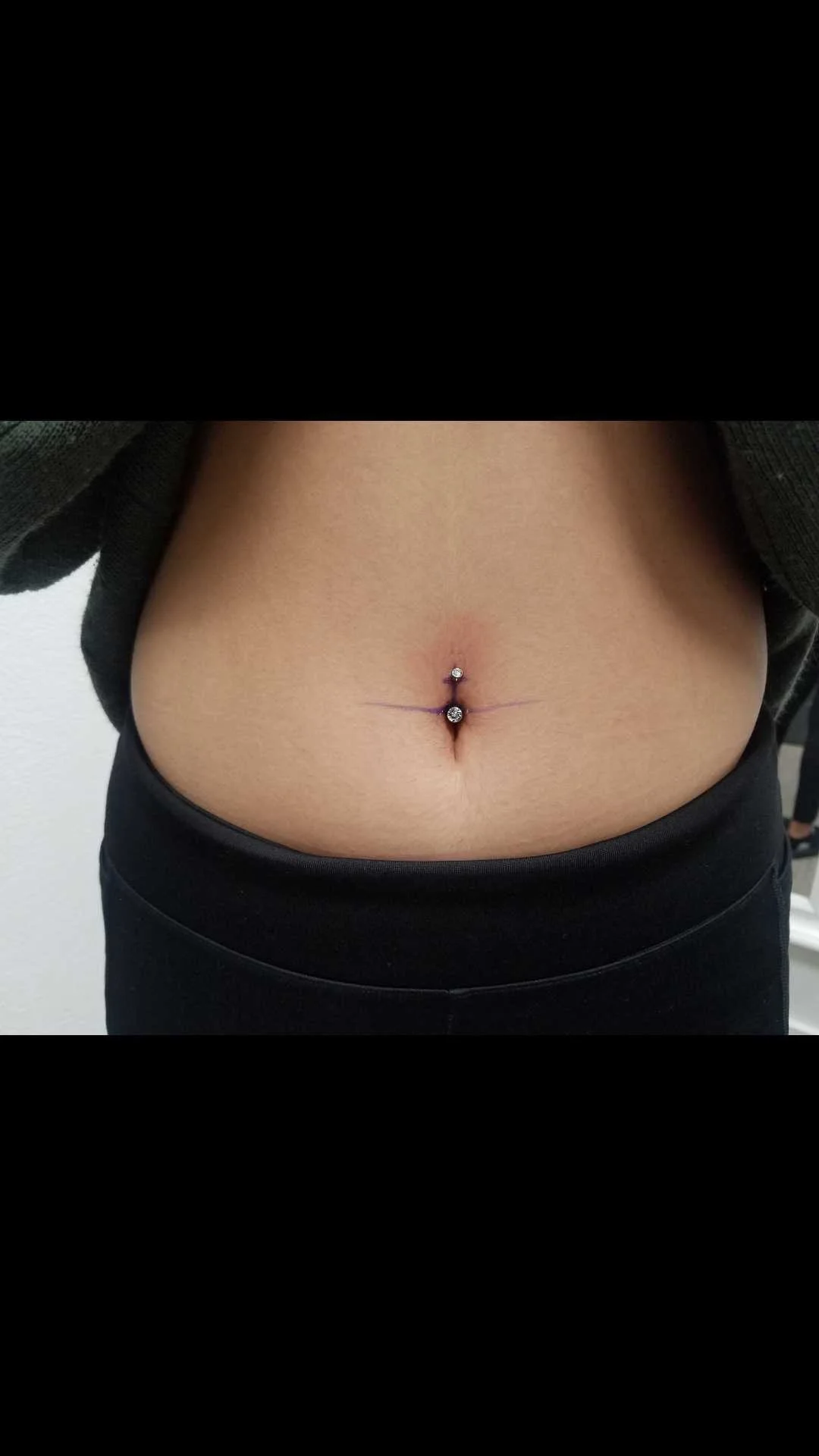 Close-up of a navel piercing with a barbell jewelry and dark markings on the skin.