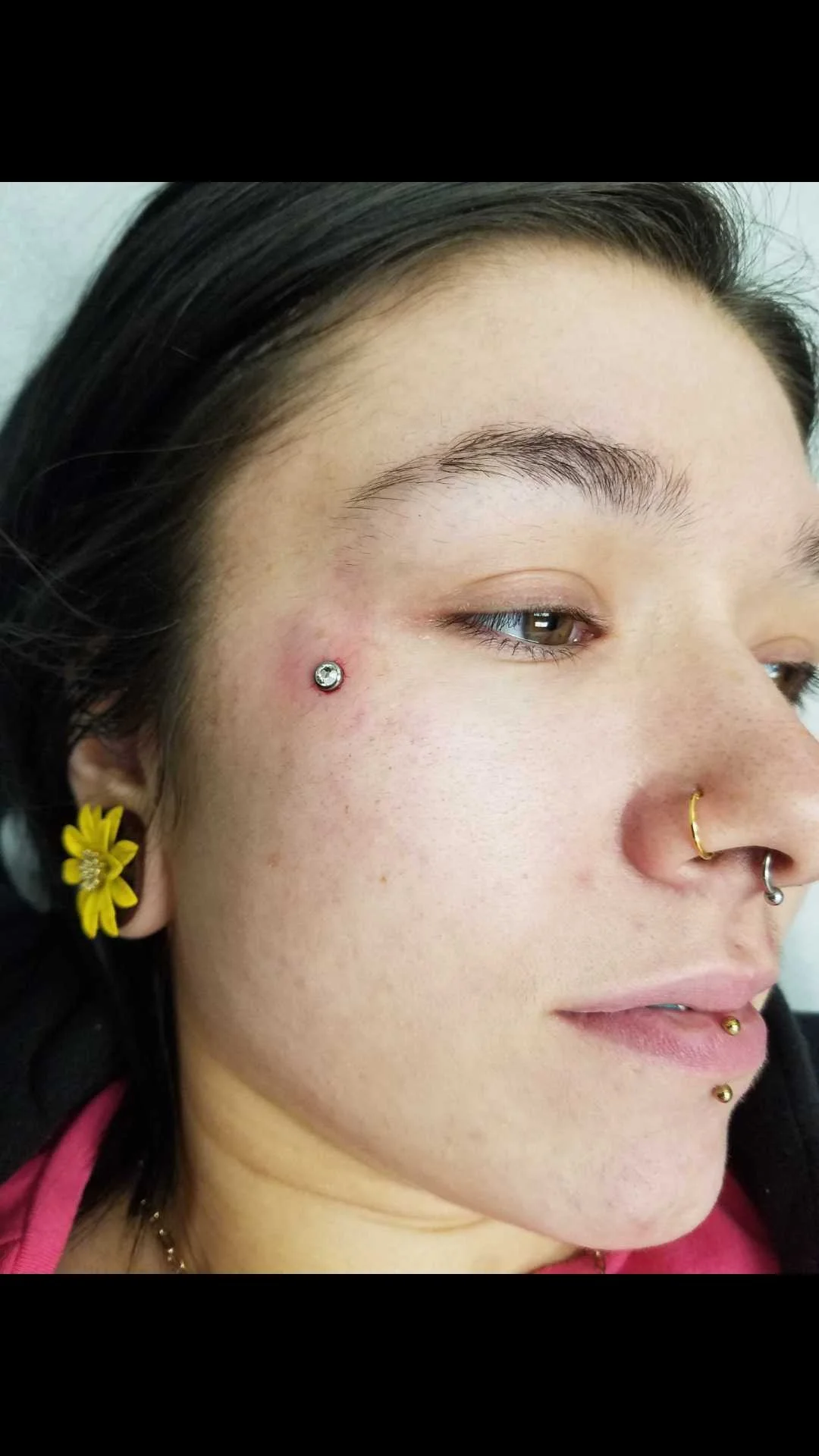 Close-up of a person's face with a dermal piercing near the eye, a yellow flower earring, a nose ring, and lip piercings.