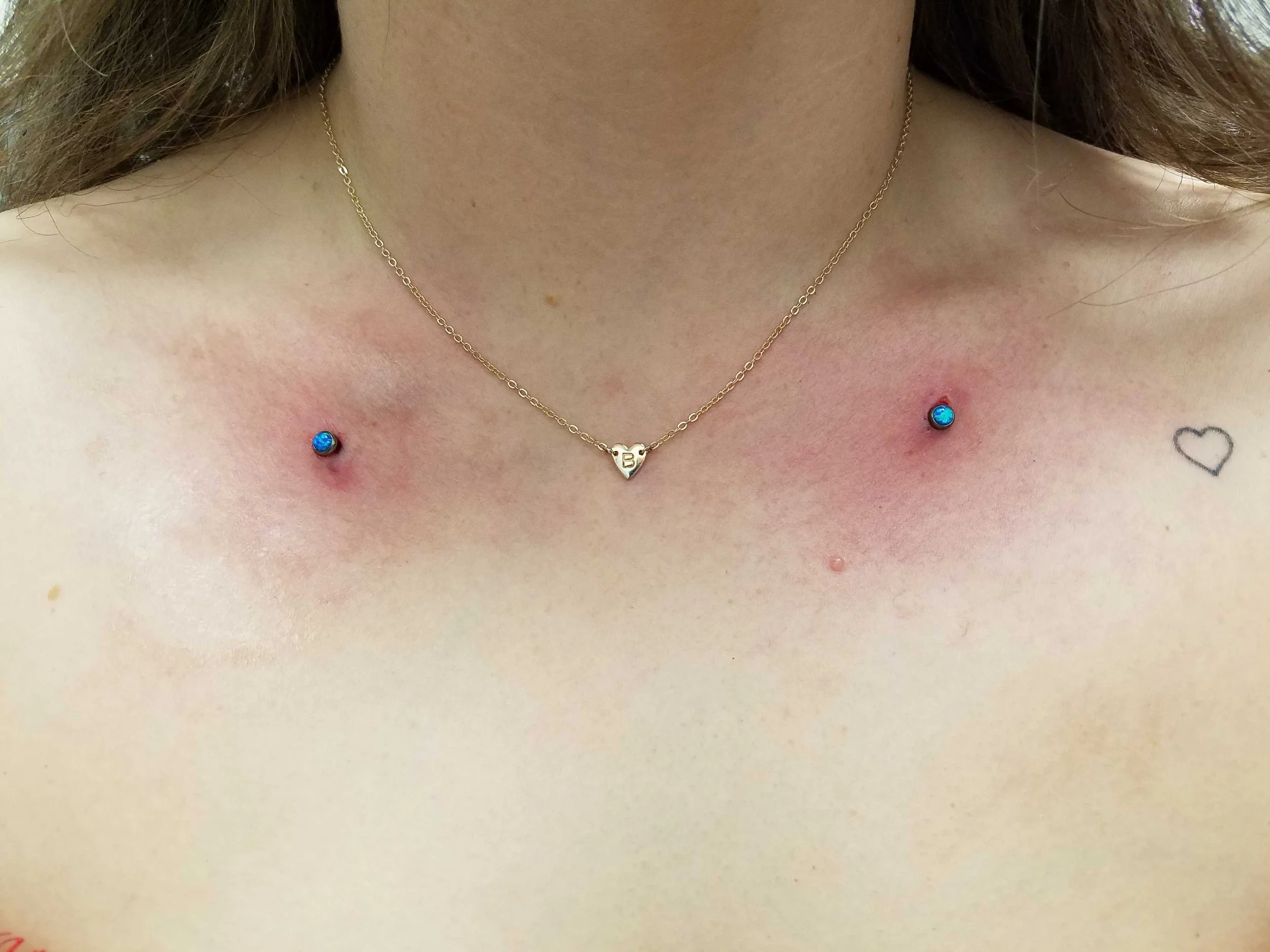 Close-up of a person's neck showing a necklace and two blue dermal piercings above the collarbone, with slight redness around them. A small heart tattoo is visible nearby.