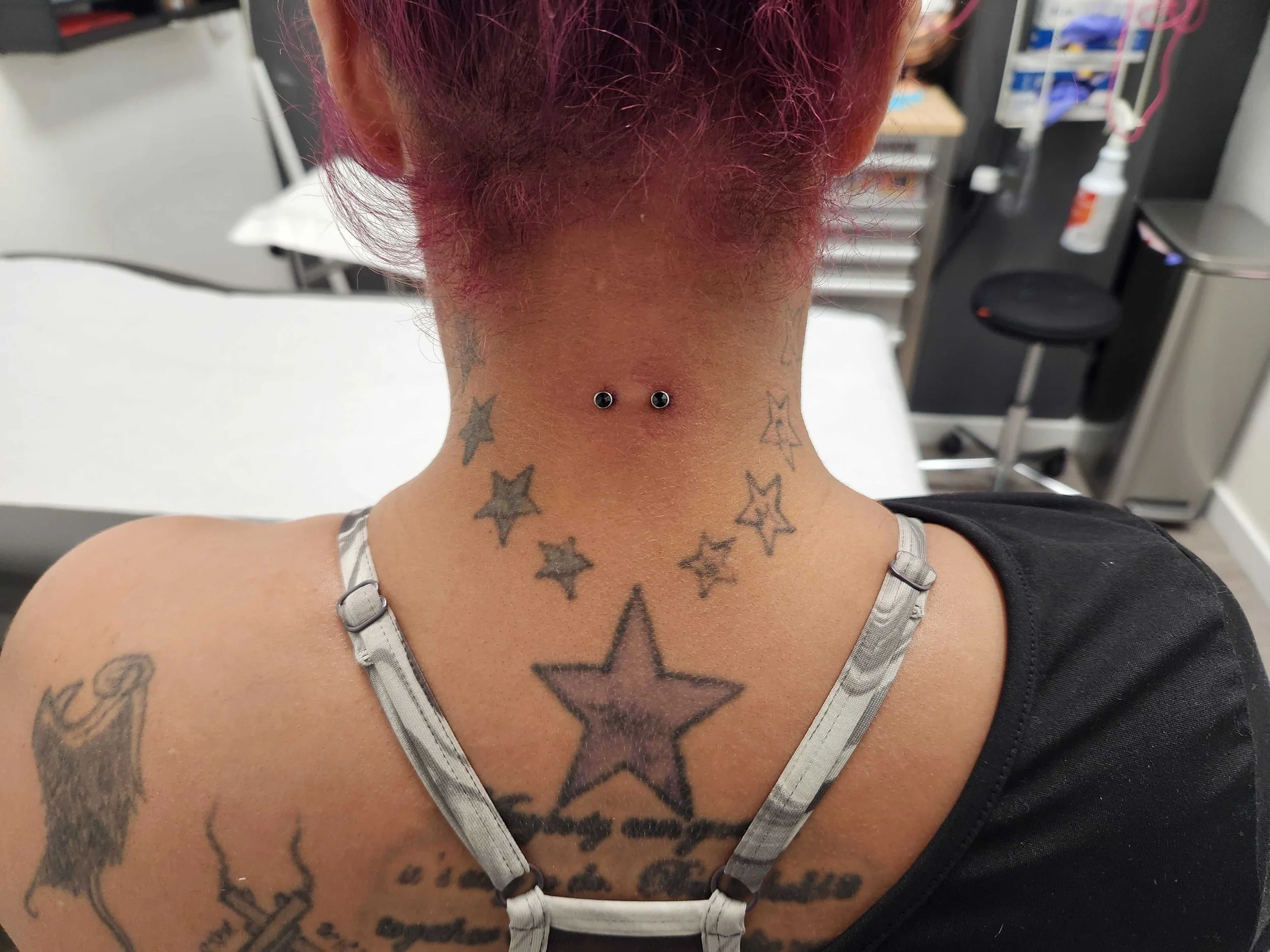 Person showing neck tattoos of stars and text, with a dermal piercing on the back of the neck, in a clinical or studio setting.