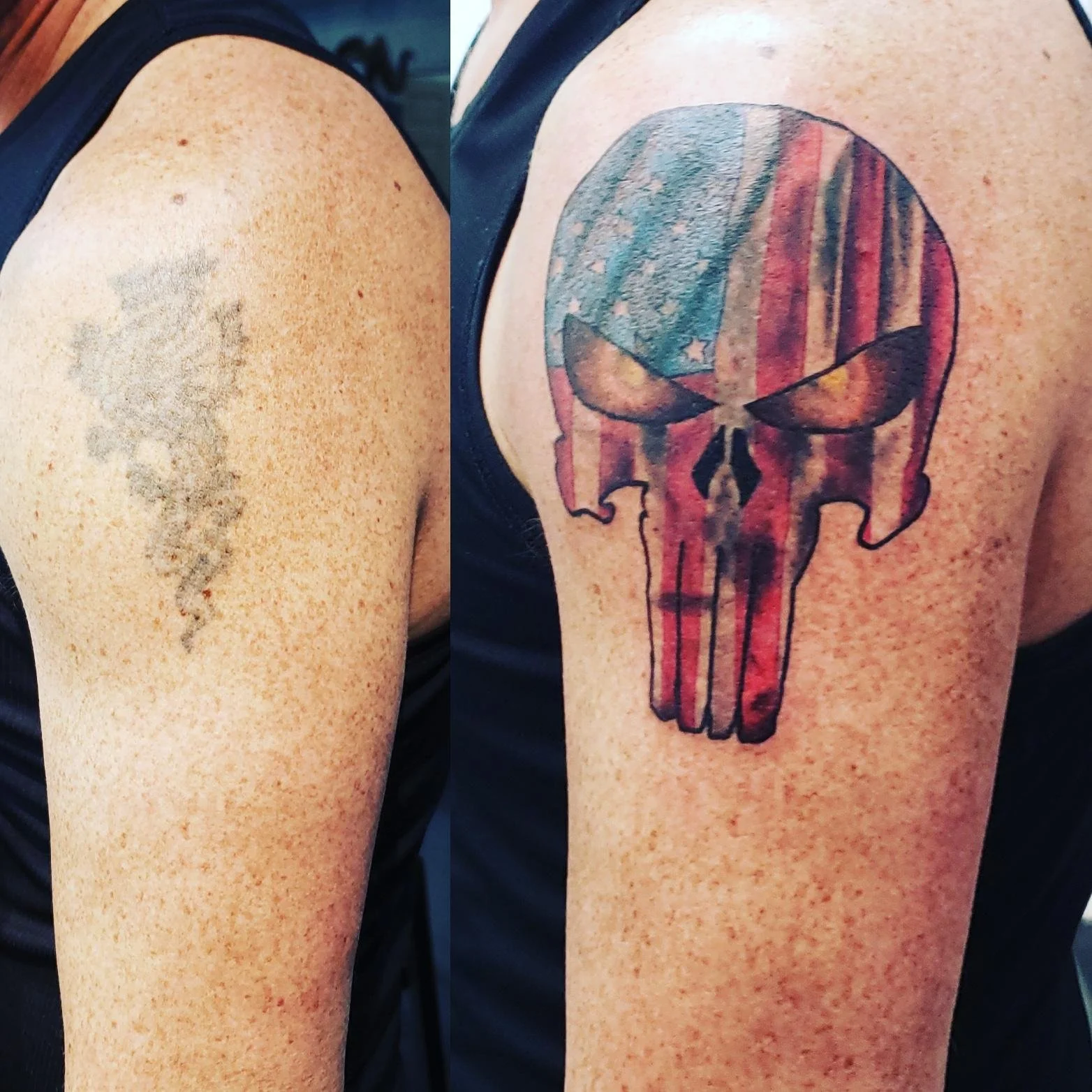 Side-by-side comparison of a shoulder tattoo transformation; left: faded tattoo, right: new, vibrant skull tattoo with American flag design.