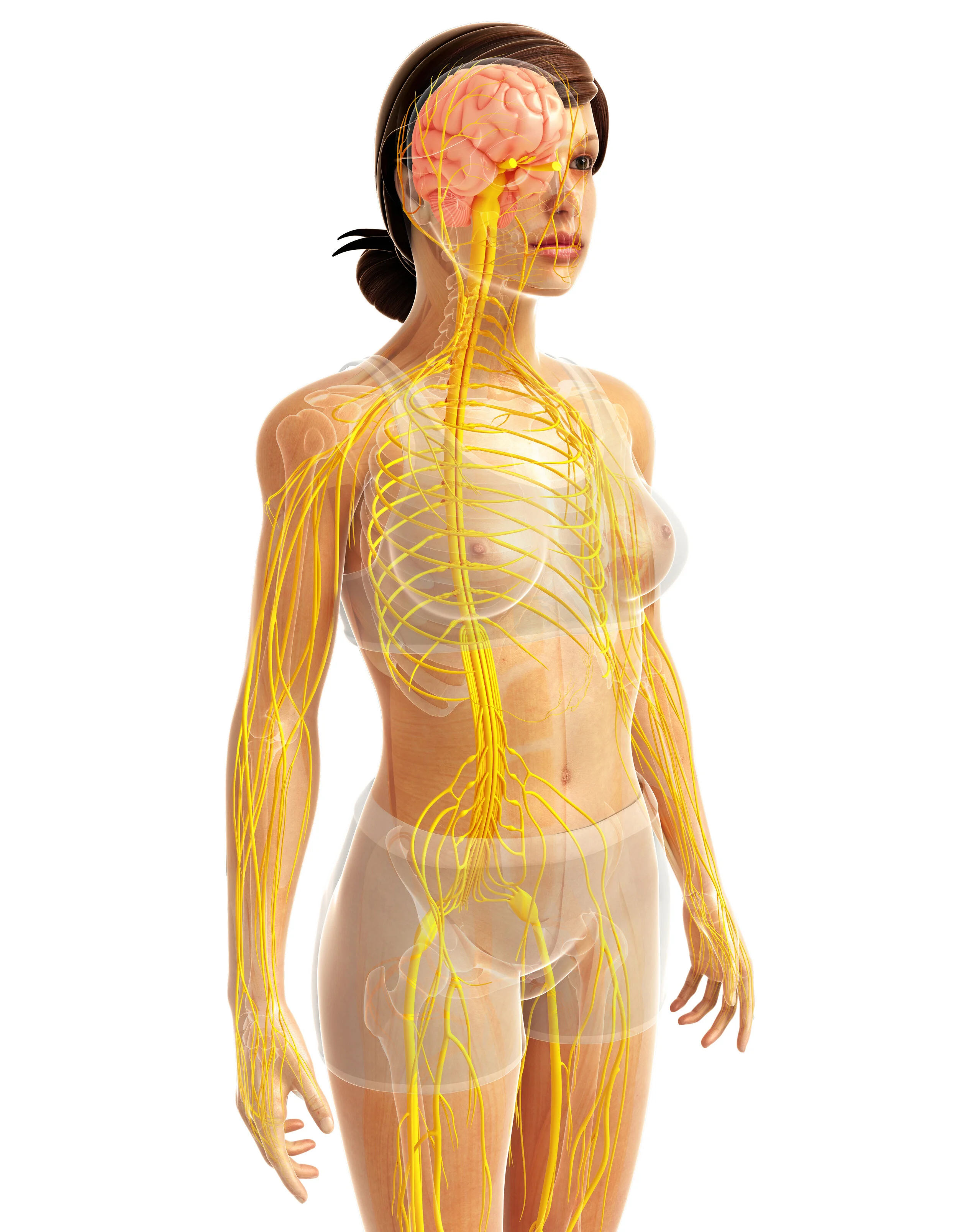 Sciatica