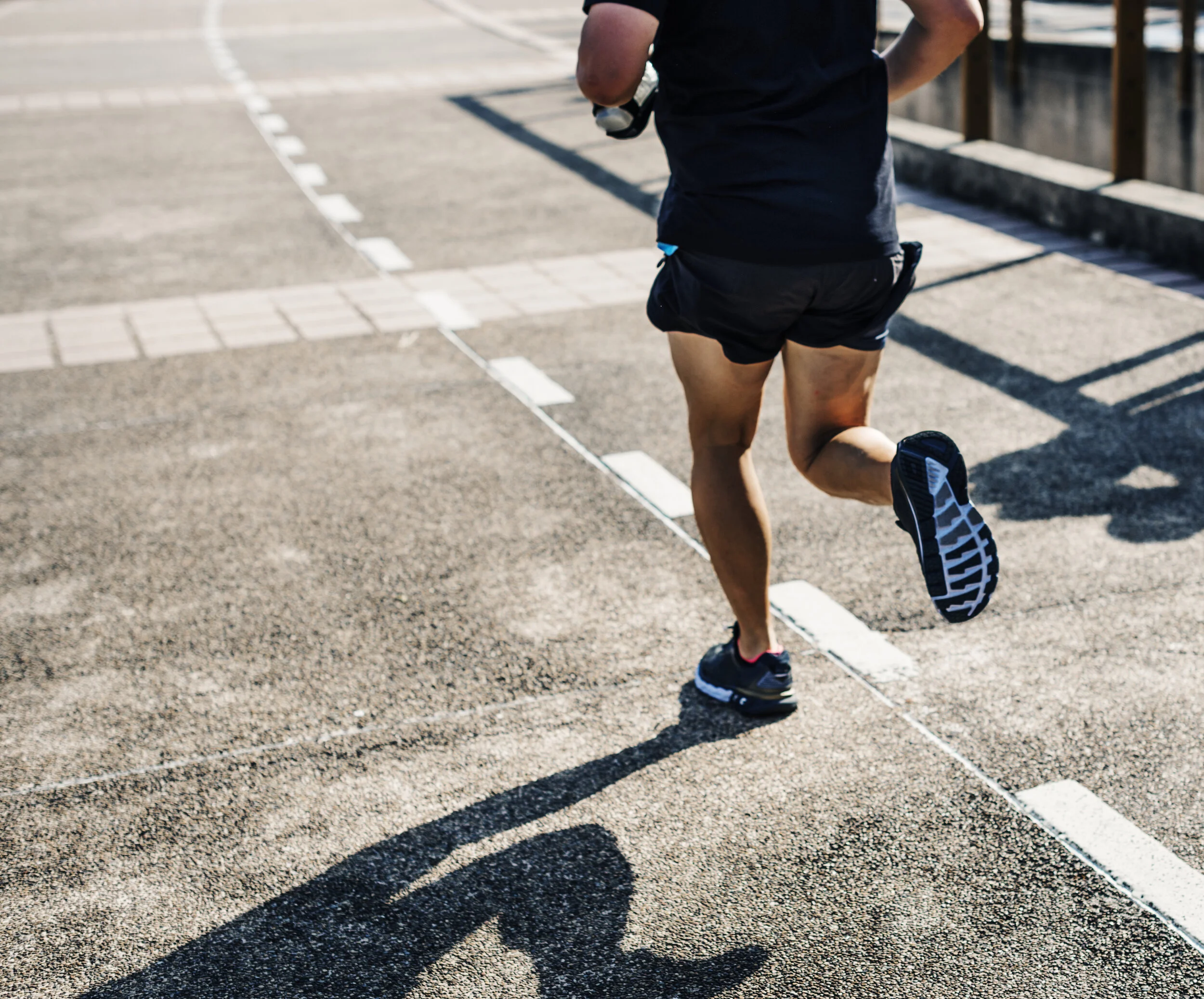 plantar fasciitis