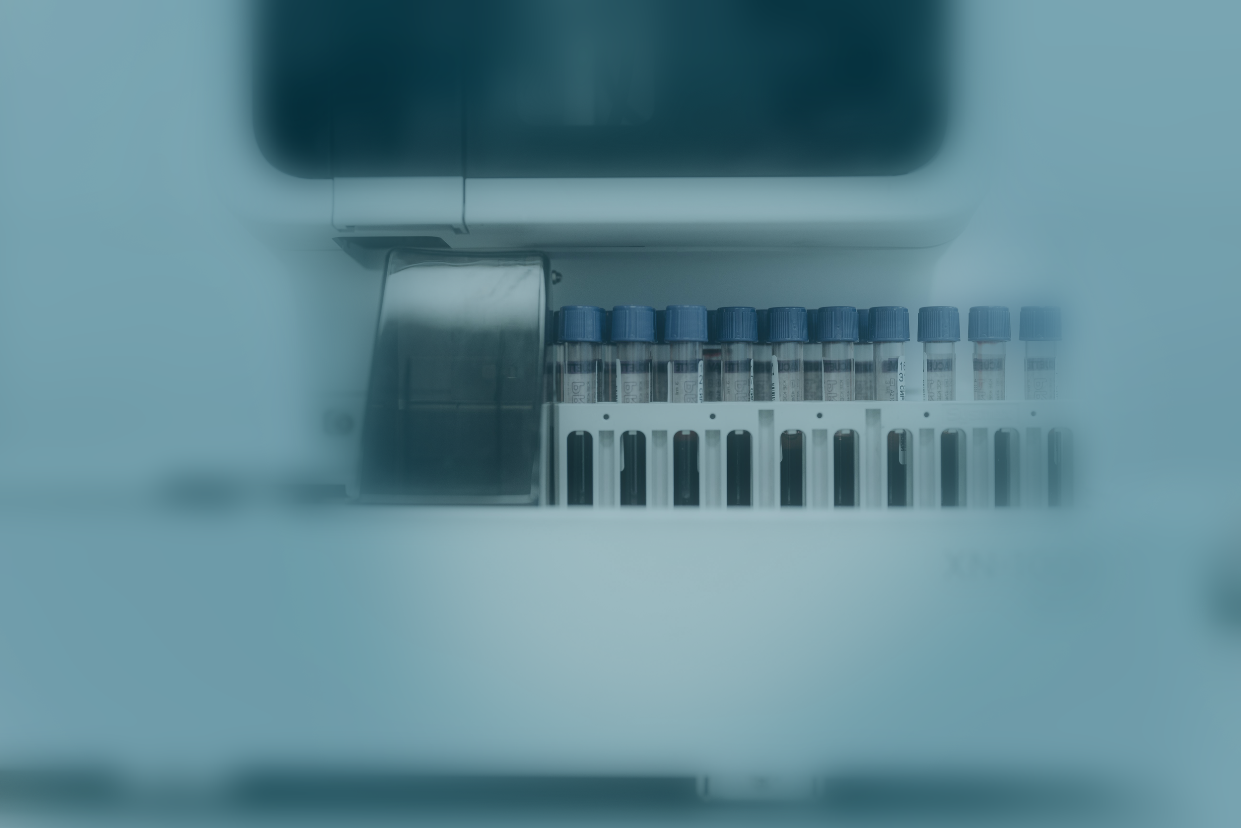 A blue tinted photo of vials ready for diagnsotic testing.