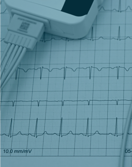 A blue tinted photo of EMG medical results.
