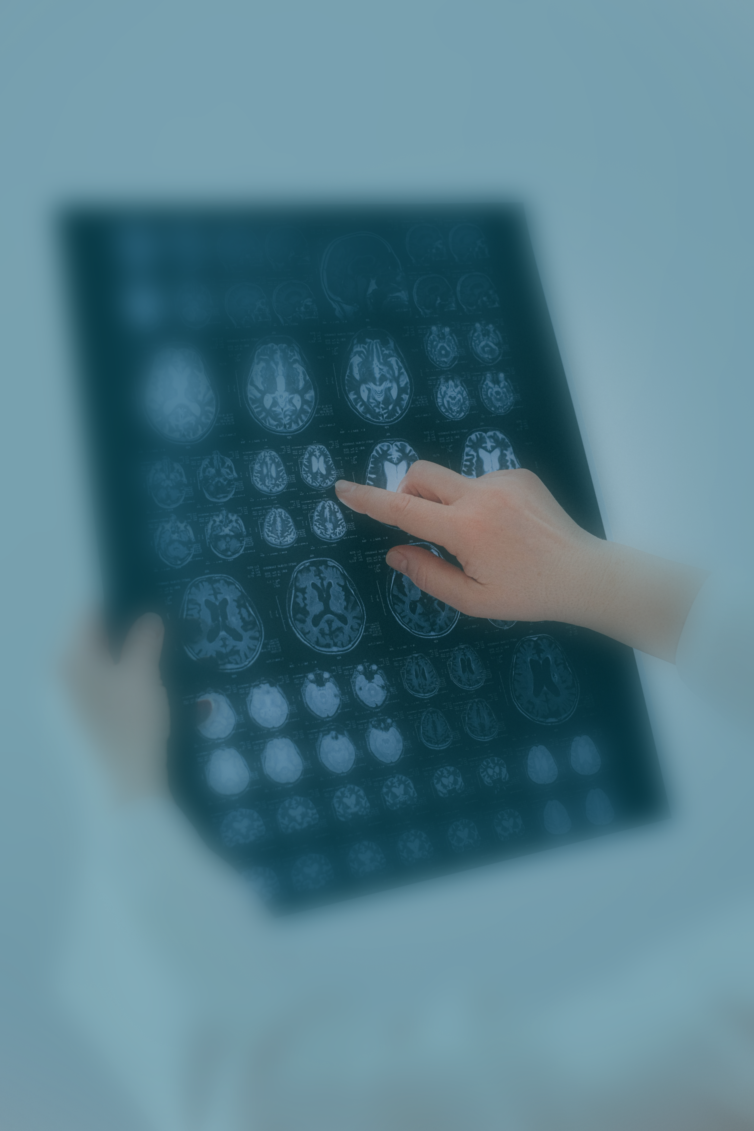 A blue tinted photo of a brain scan.