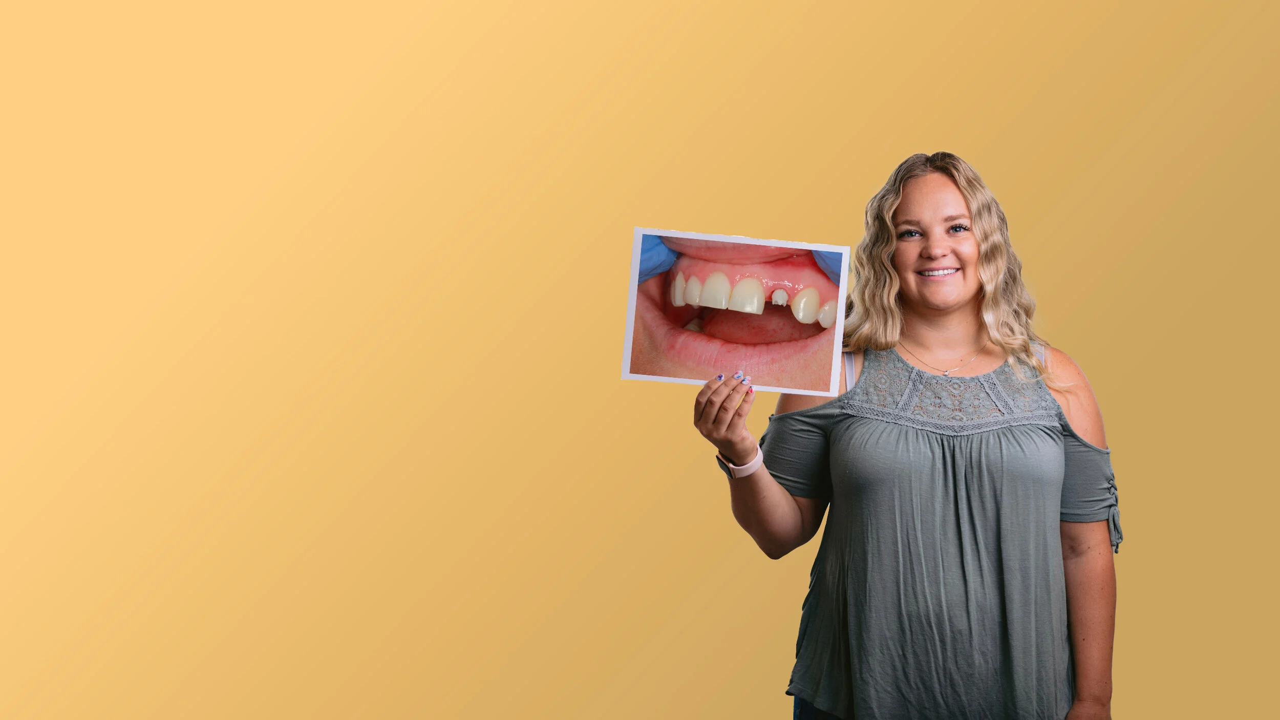  “It was such a smooth process from start to finish and I was back to normal quickly.”   See Before &amp; Afters  