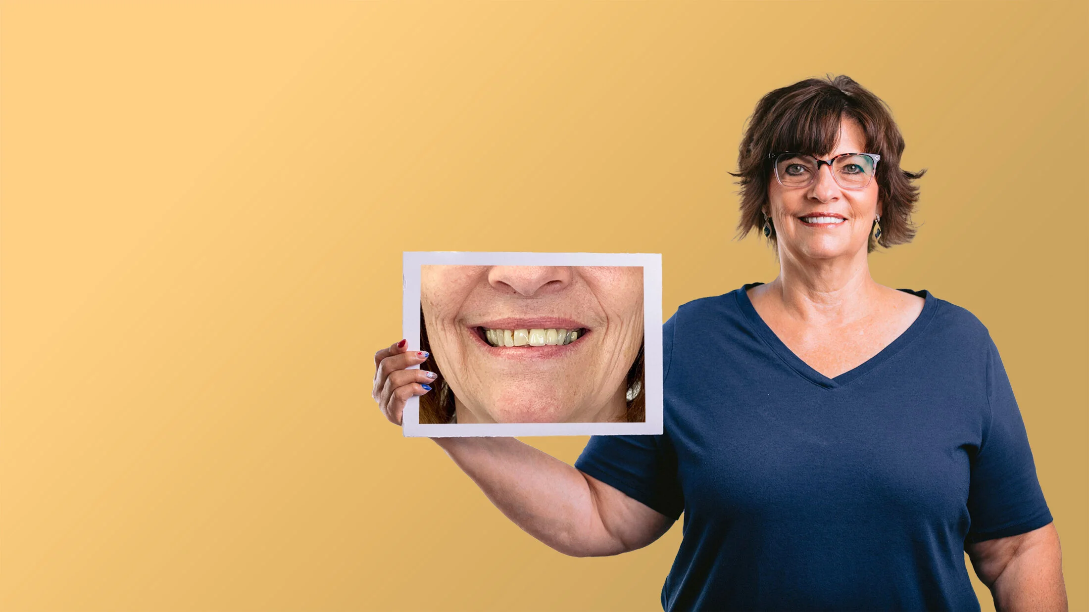  “I’ve been to multiple places, but it wasn’t until I visited Dr. Cady that I was able to get the smile I’ve always wanted.”   See Before &amp; Afters  