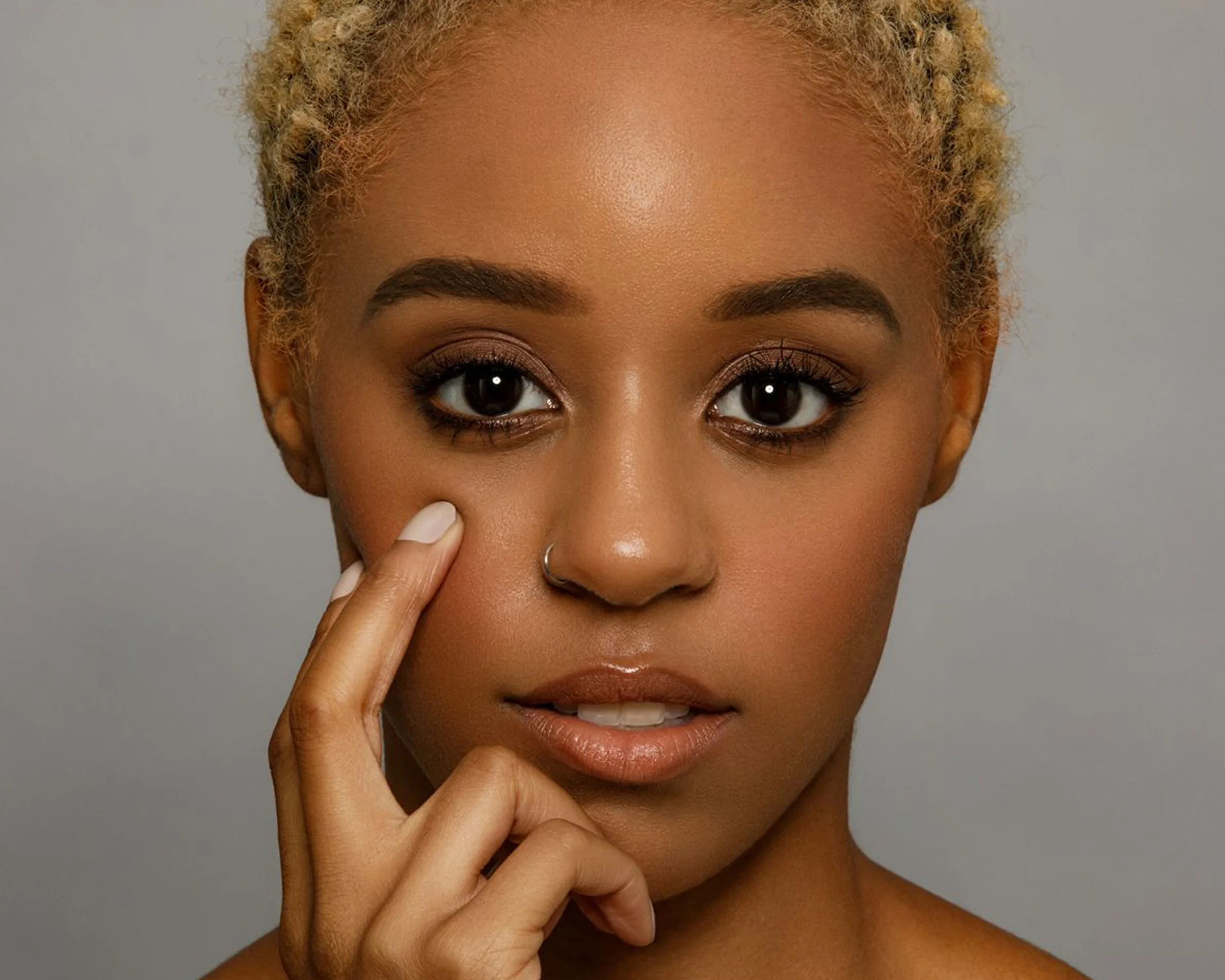 How to Manage Chronic Acne-Prone Skin