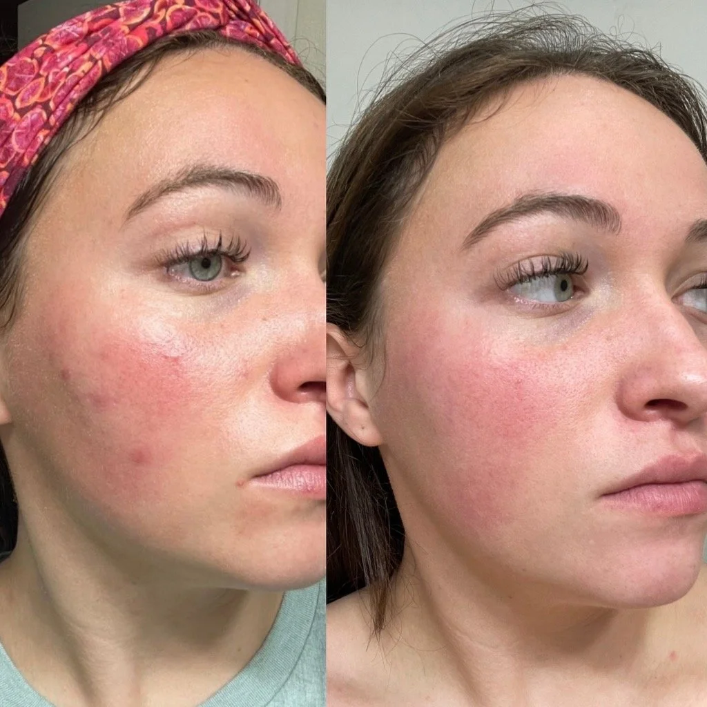 Untitled design 2.JPEG