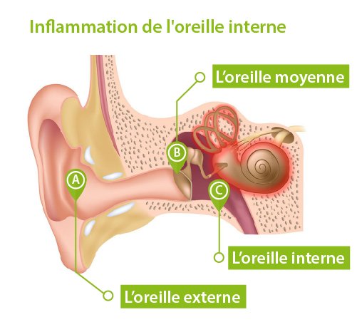 Votre Chiro Peut Vous Aider Avec Vos Vertiges? — Clinique CHIRO+ ...