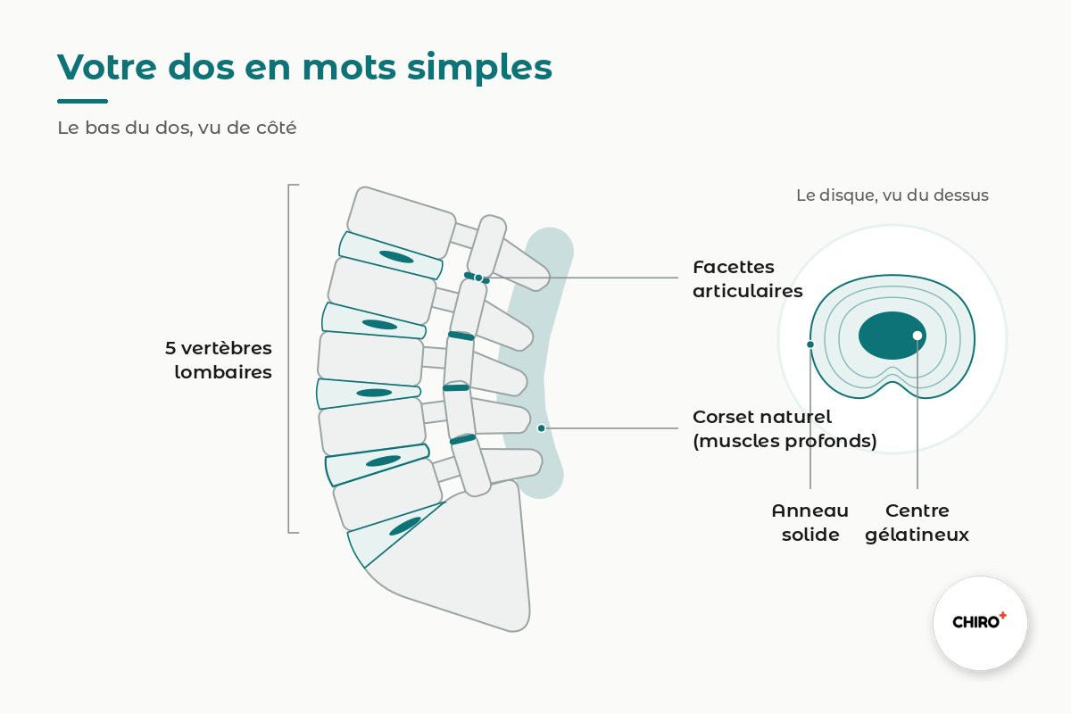 Schéma du bas du dos vu de côté : vertèbres lombaires, disques, facettes articulaires et muscles profonds, avec un disque vu du dessus (anneau solide et centre gélatineux) — Clinique CHIRO+ Ste-Thérèse
