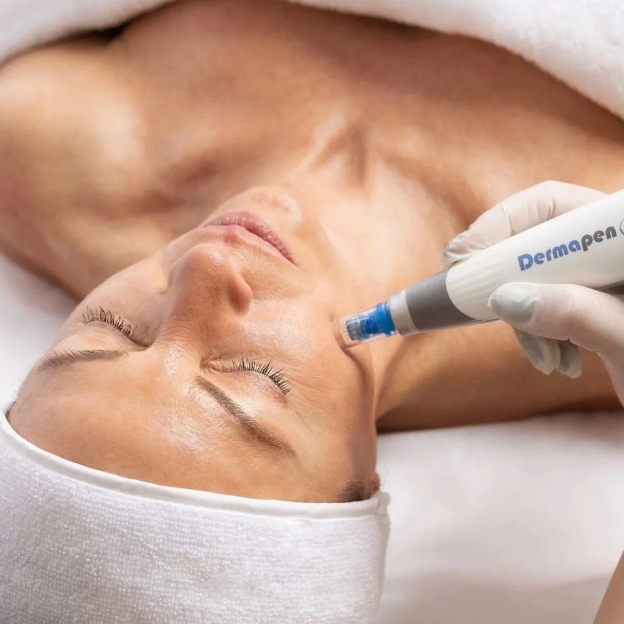 SKIN NEEDLING (aka Dermapen, as this is the device we use) 🫶🏼

You&rsquo;re probably seeing a lot of hype around skin needling from us lately, and for good reason! We have been offering this skin remodelling treatment for many years and have had mu