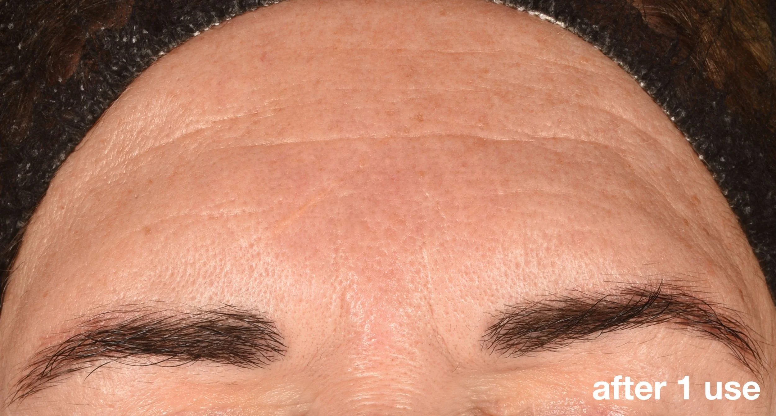 Phyto Nature E2_B&A Crops_After 1 Use.jpg (Copy)