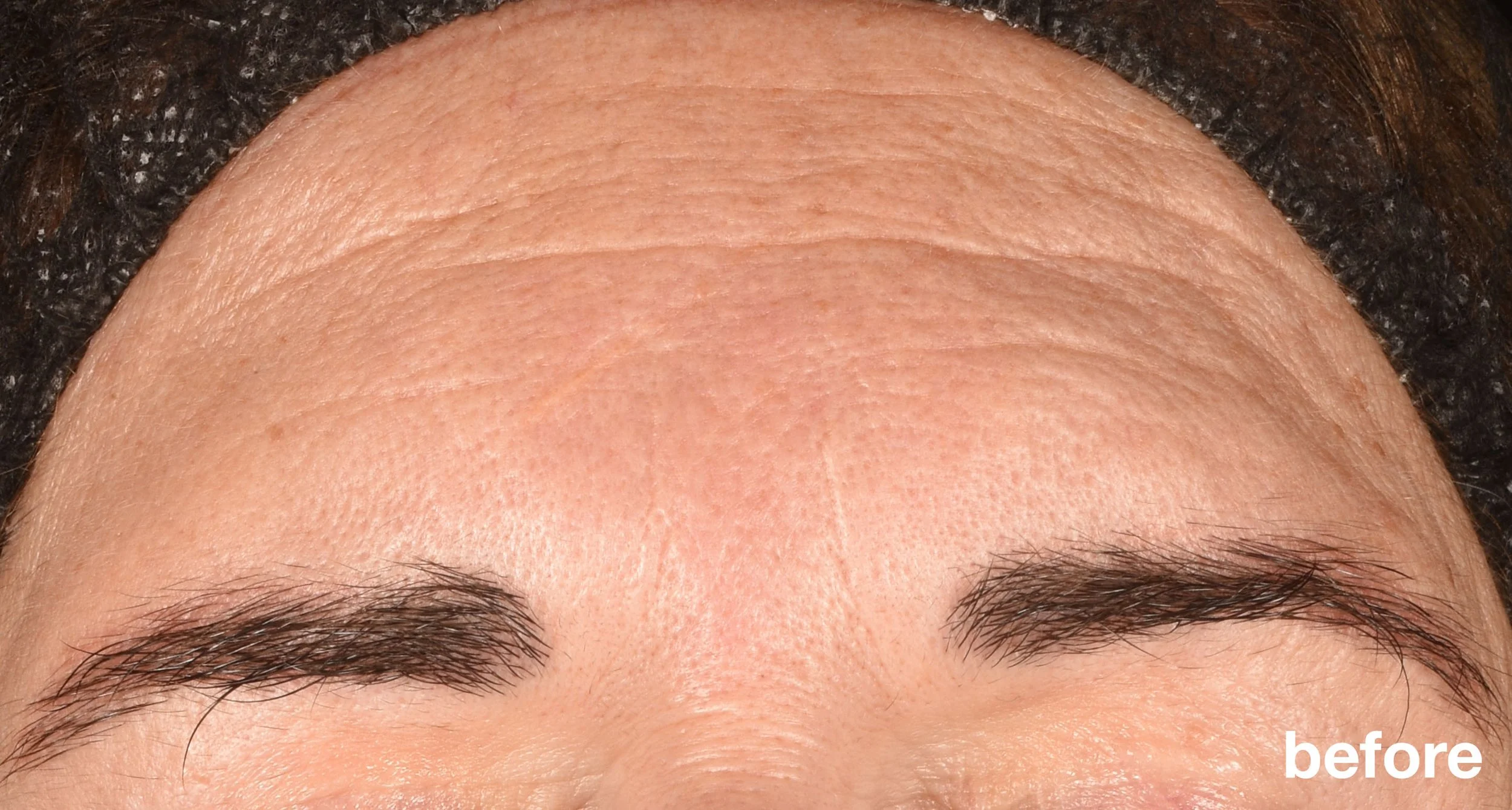 Phyto Nature E2_B&A Crops_Before.jpg (Copy)