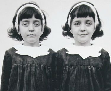   Credit: Diane Arbus. (This photo is often used online to portray the Pollock twins yet it was taken by photographer Arbus in New Jersey in 1966 and is of identical twins “Cathleen” and “Colleen.”)  