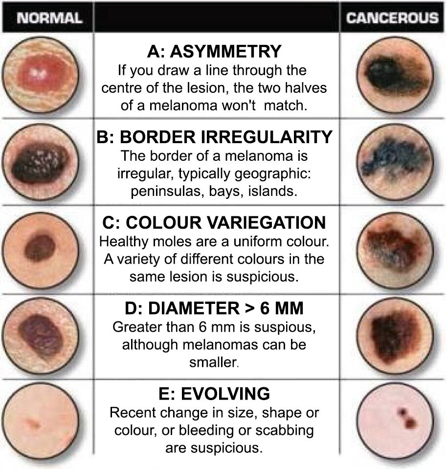 Full Body Skin Exam — The Center For Excellence In Dermatology