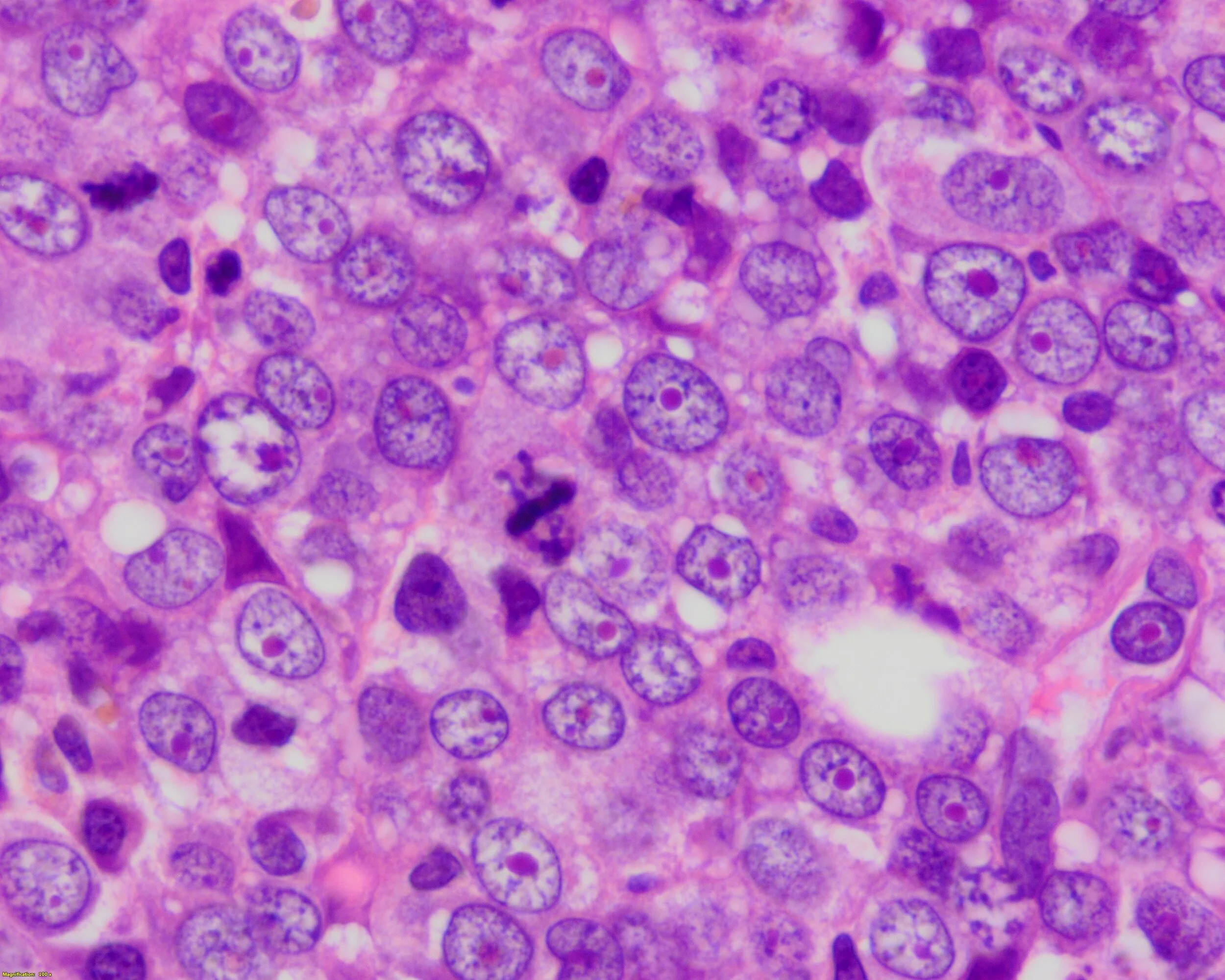 Hematopathology — PathElective