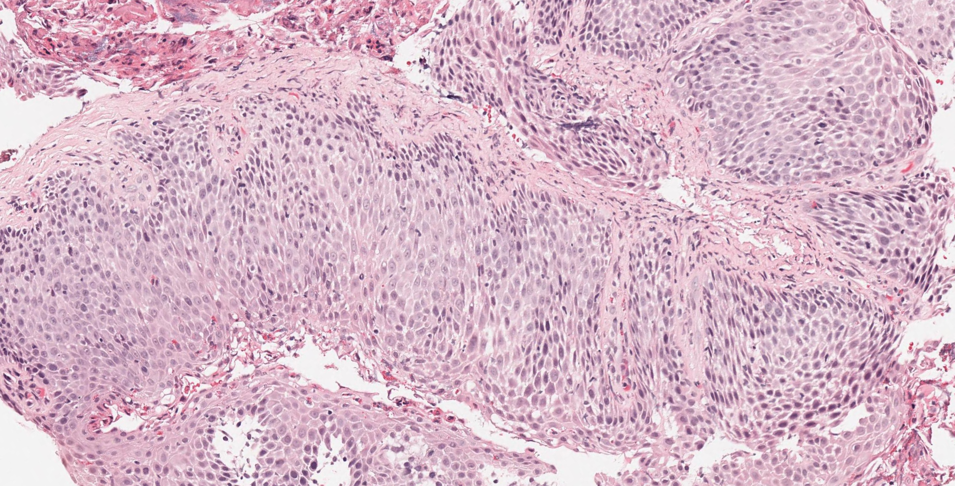 GI Pathology Lesson 1 — PathElective