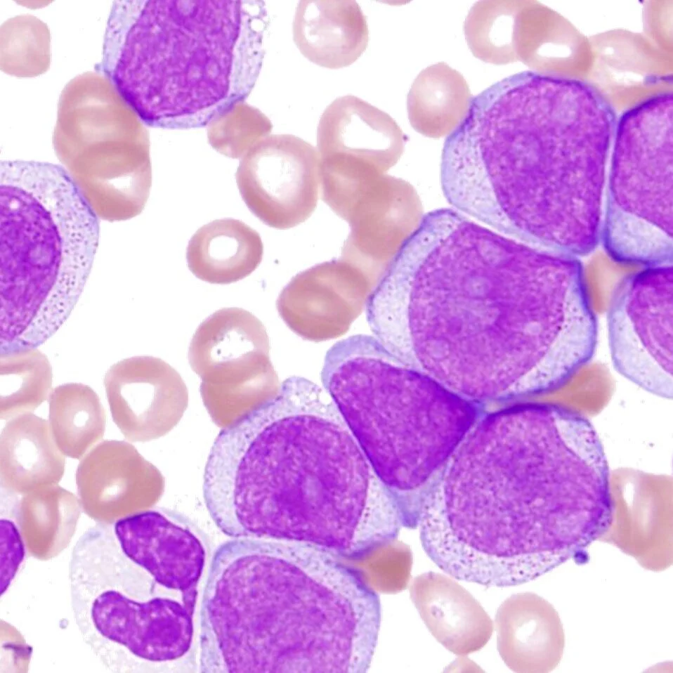 Hematopathology — PathElective