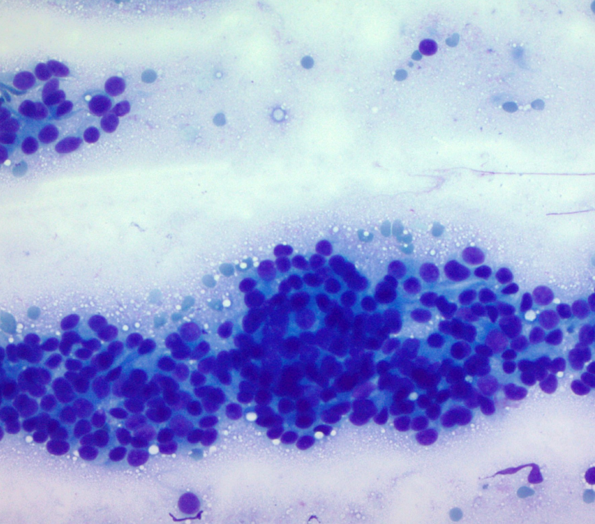 Cytopathology — PathElective