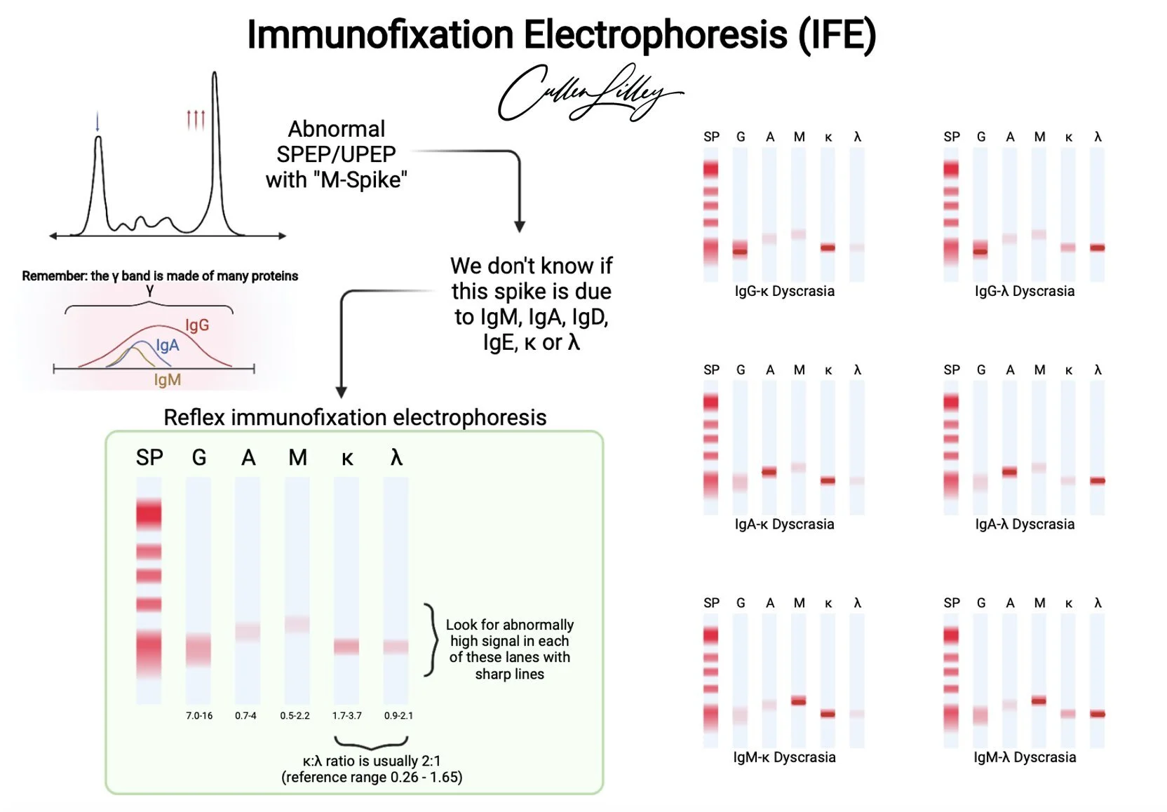 Serum Protein Electrophoresis And Immunofixation 56 OFF Serum Protein Electrophoresis And Immunofixation 56 OFF