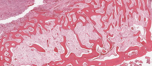 Bone and Soft Tissue Lesson 2: BST Pathology For Beginners — PathElective