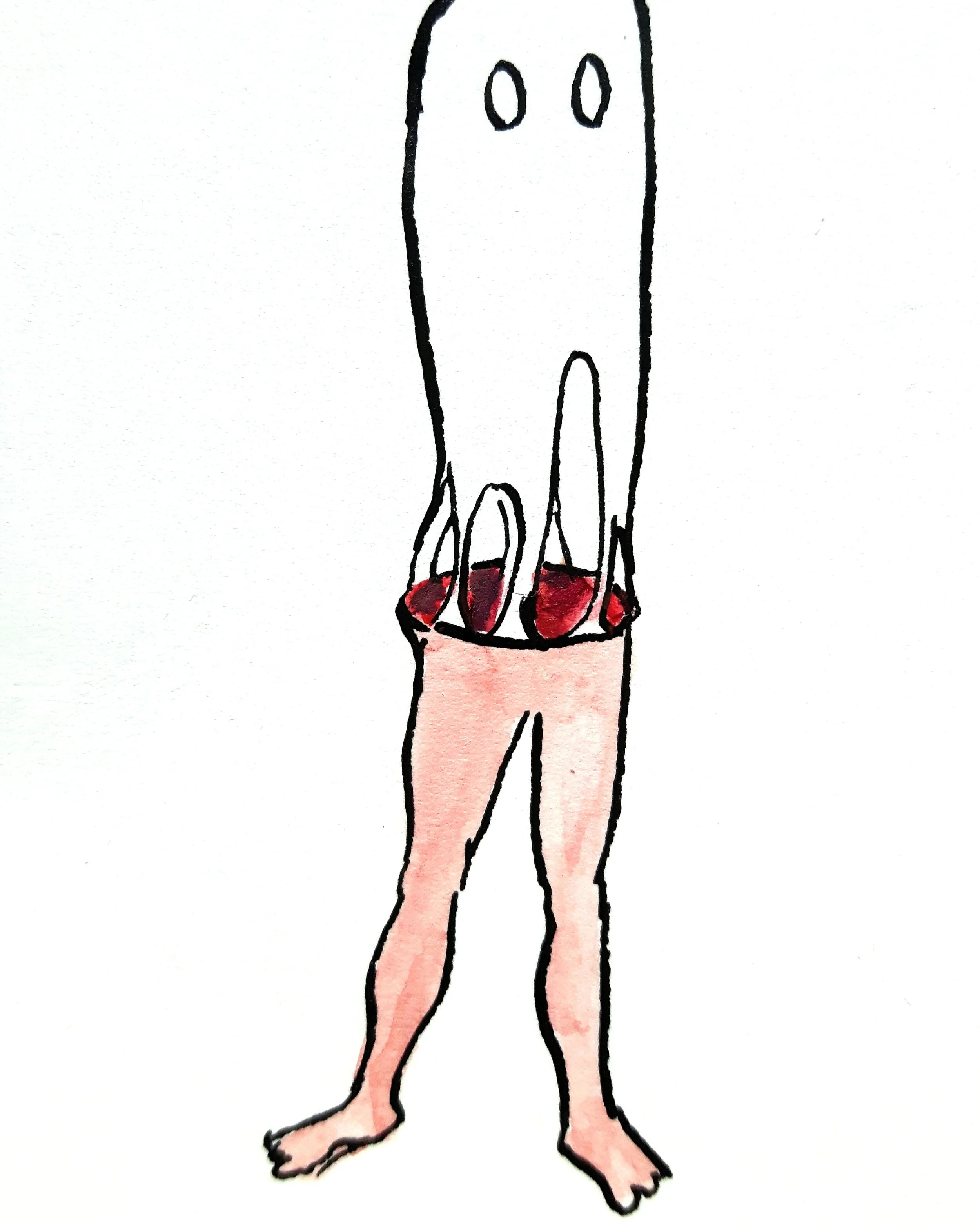 Amputation