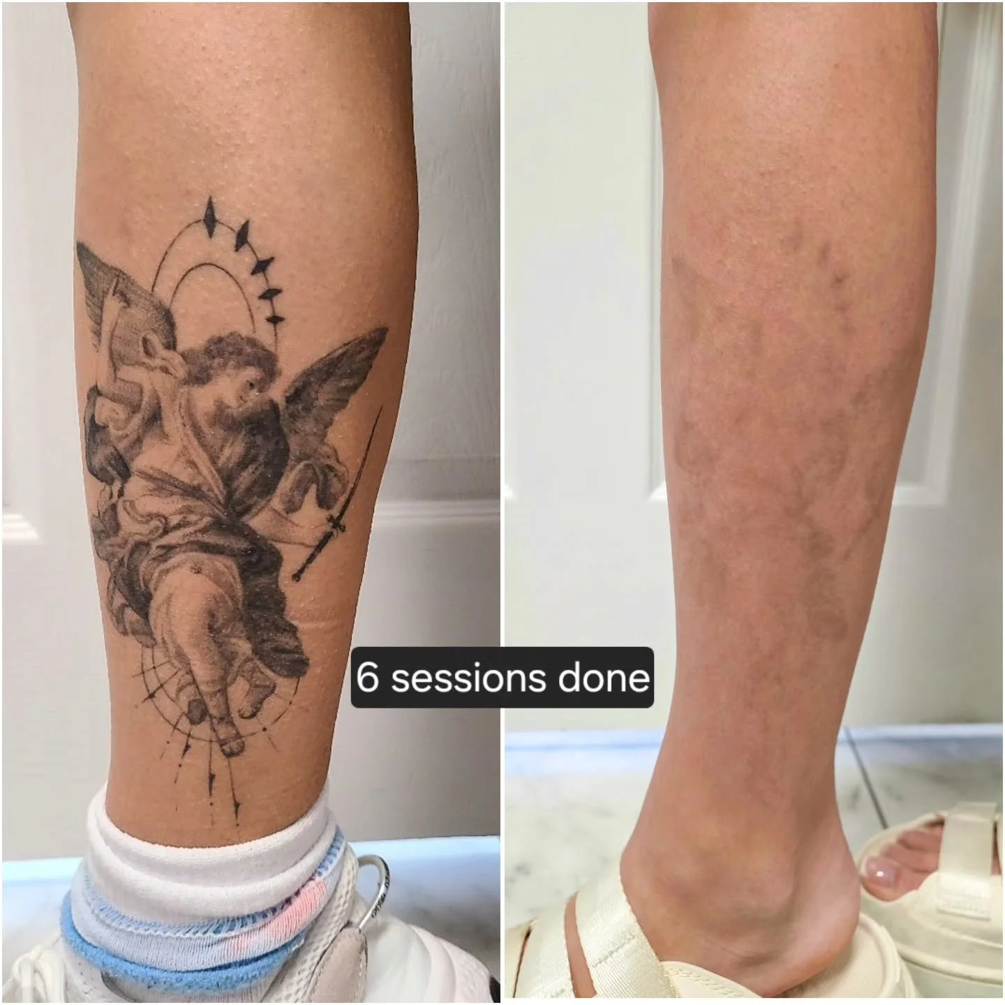 Really happy with this! Please note: Everyone's body works differently, and results can vary depending on how strong a person's immune system is, the style/ink used, how healthy of a lifestyle a person lives...etc.

For any questions or inquiries fre