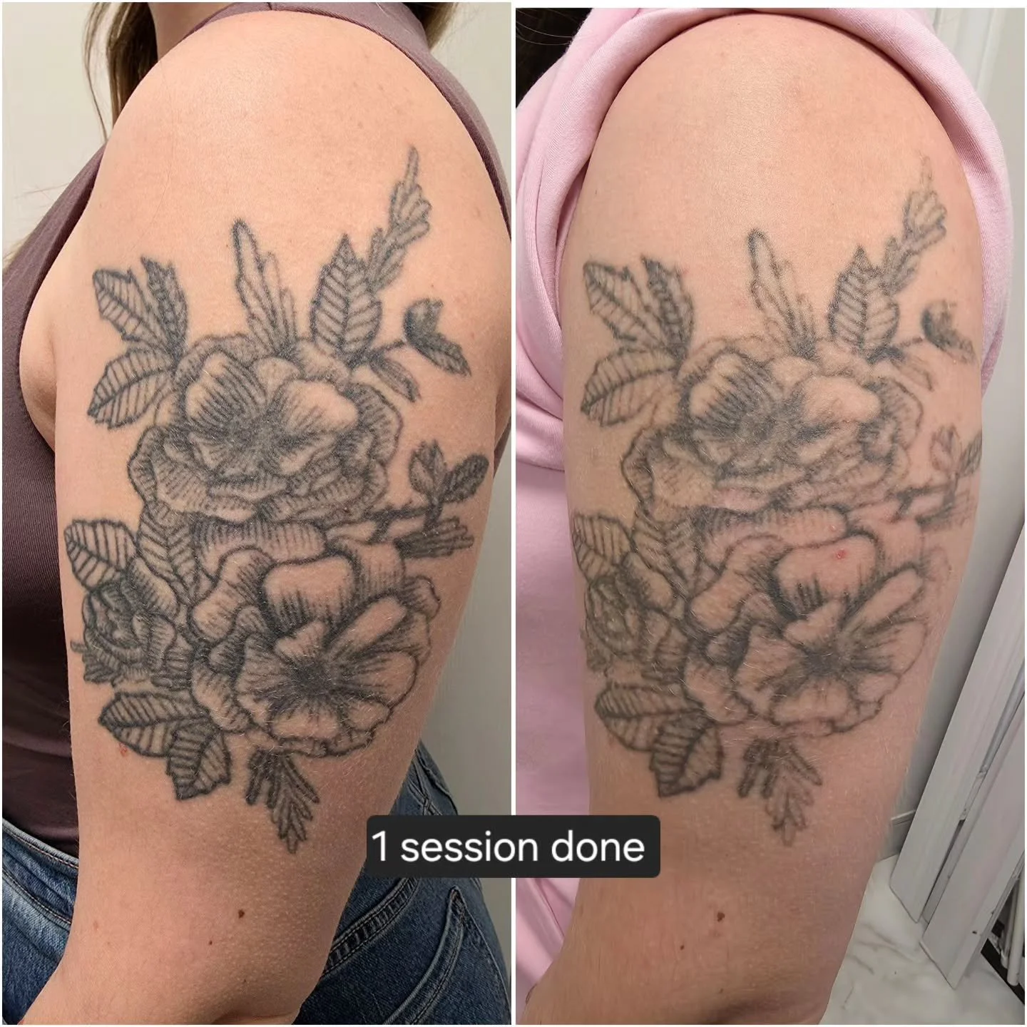 Lots of lightening up after just 1! Everyone's body works differently, and results can vary depending on how strong a person's immune system is, the style/ink used, how healthy of a lifestyle a person lives...etc.

For any questions or inquiries free