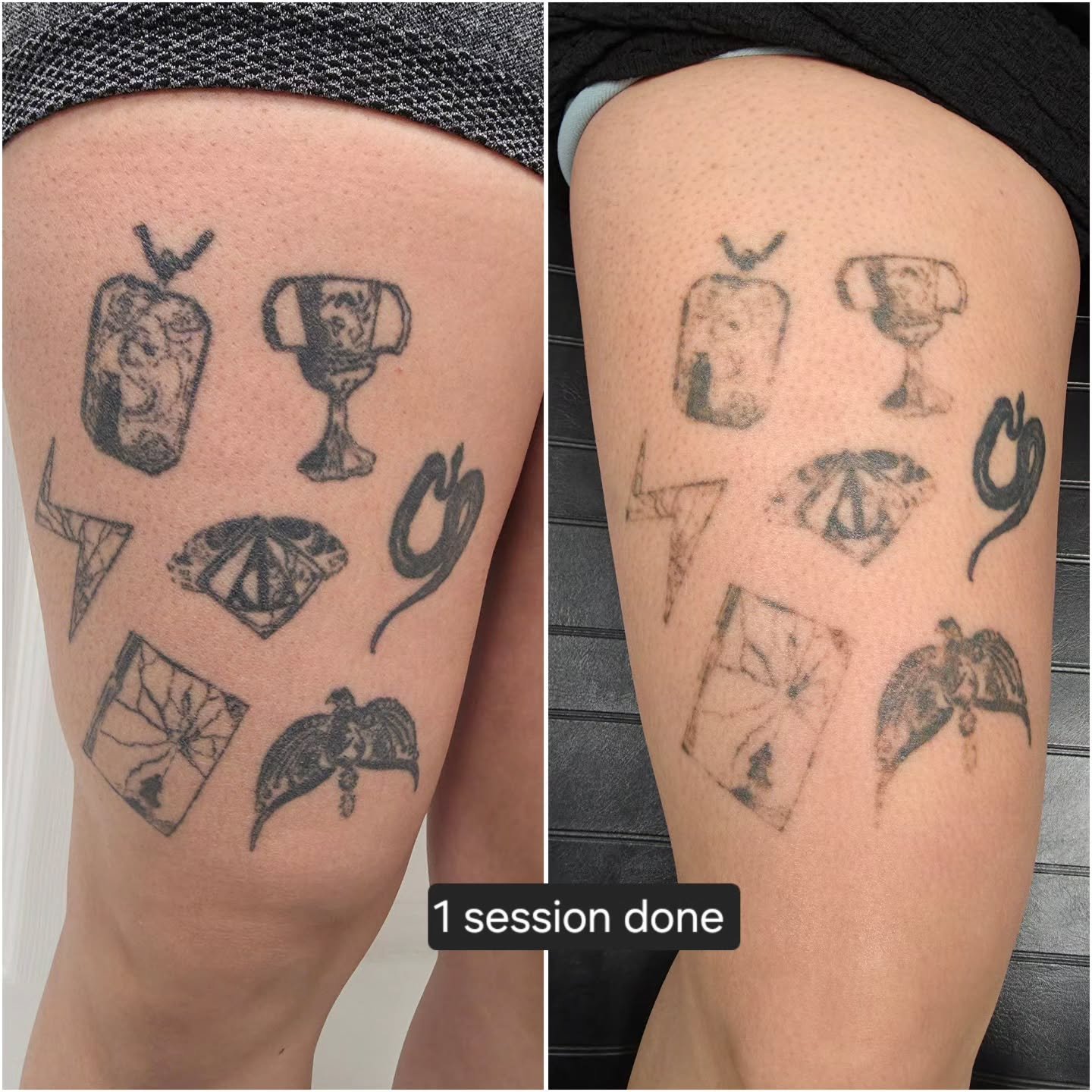 1st session done on this piece (**we didnt do the snake thats why theres no change on it) Everyone's body works differently, and results can vary depending on how strong a person's immune system is, the style/ink used, how healthy of a lifestyle a pe