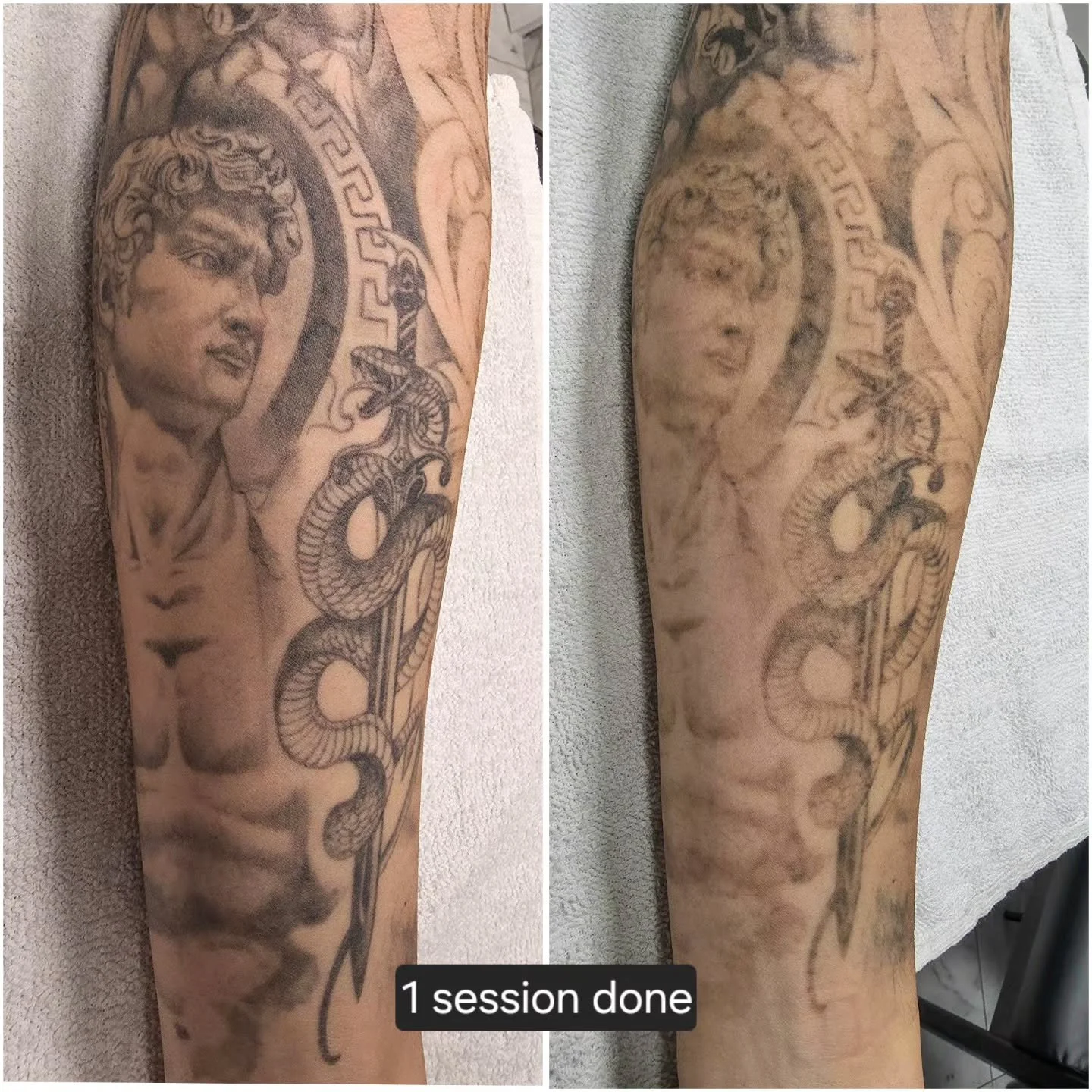 Everyone's body works differently, and results can vary depending on how strong a person's immune system is, the style/ink used, how healthy of a lifestyle a person lives...etc. the average tattoo can take 8-12 sessions to remove. 

For any questions
