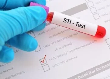 If I don’t have symptoms, do I need to have STI testing?