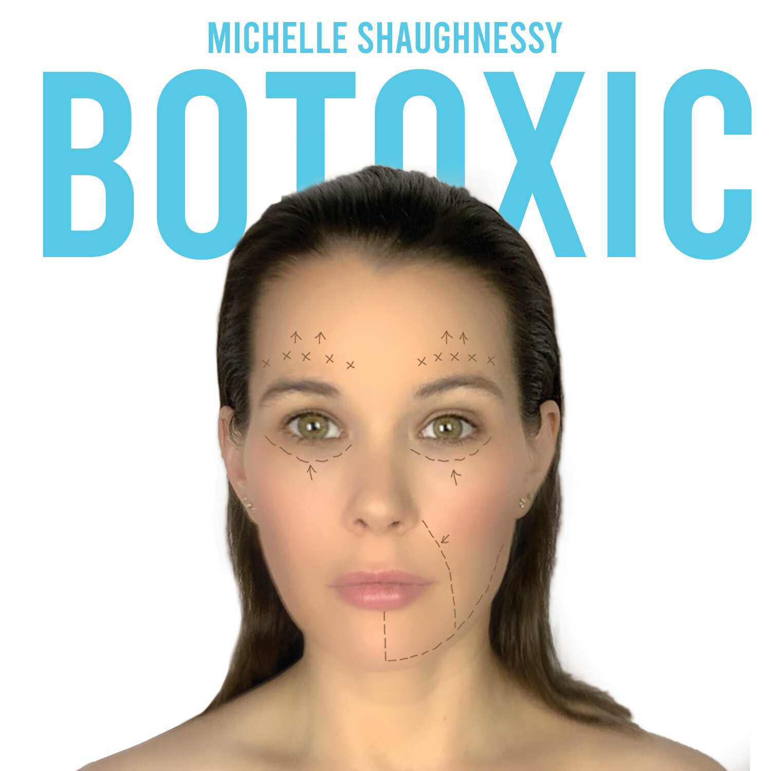 Review: Michelle Shaughnessy, Botoxic