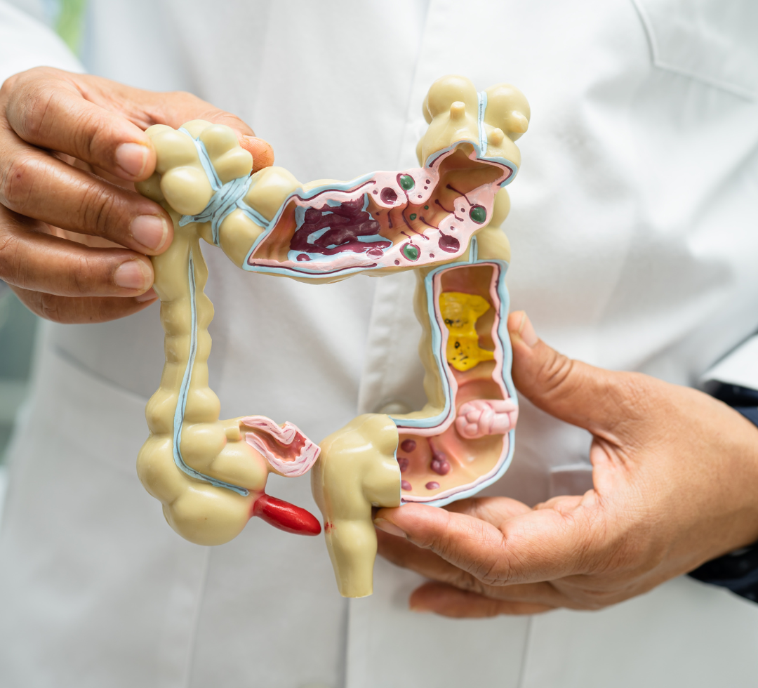 Xymogen Saccharomycin DF: Supporting Gut Health with Probiotic Capsules | Puretyclinicshop.com