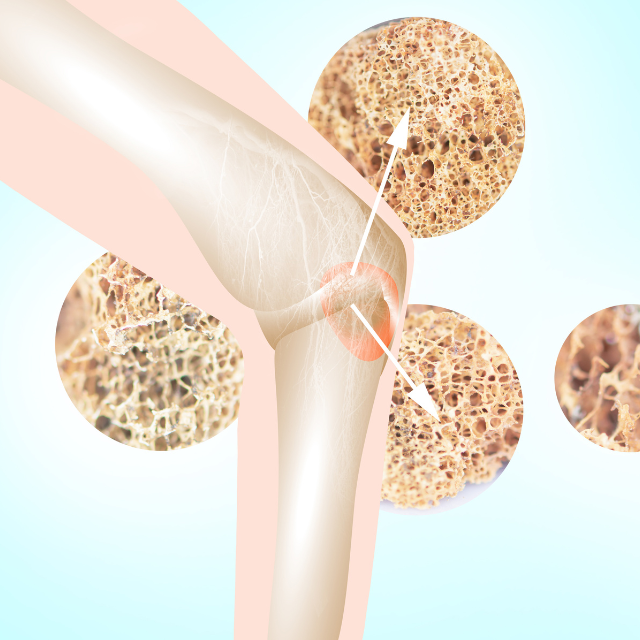 Ortho Molecular Pro Bono: Optimal Bone Health | Puretyclinicshop.com