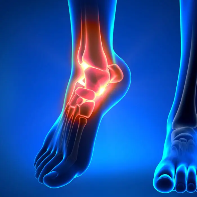 Pure Encapsulations Ligament Restore: Supporting Healthy Tendons, Ligaments, and Joints | Puretyclinicshop.com