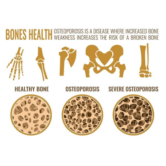 Thorne Advanced Bone Support: Providing Essential Nutrients for Bone ...