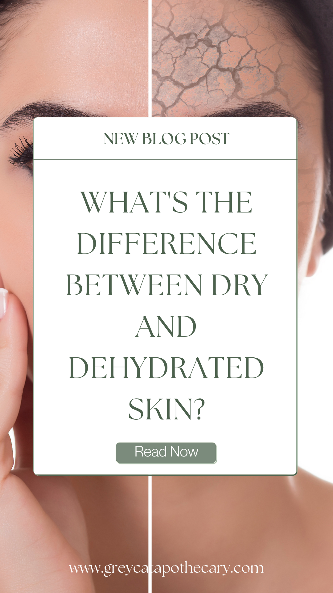 Dry Skin Blog Post