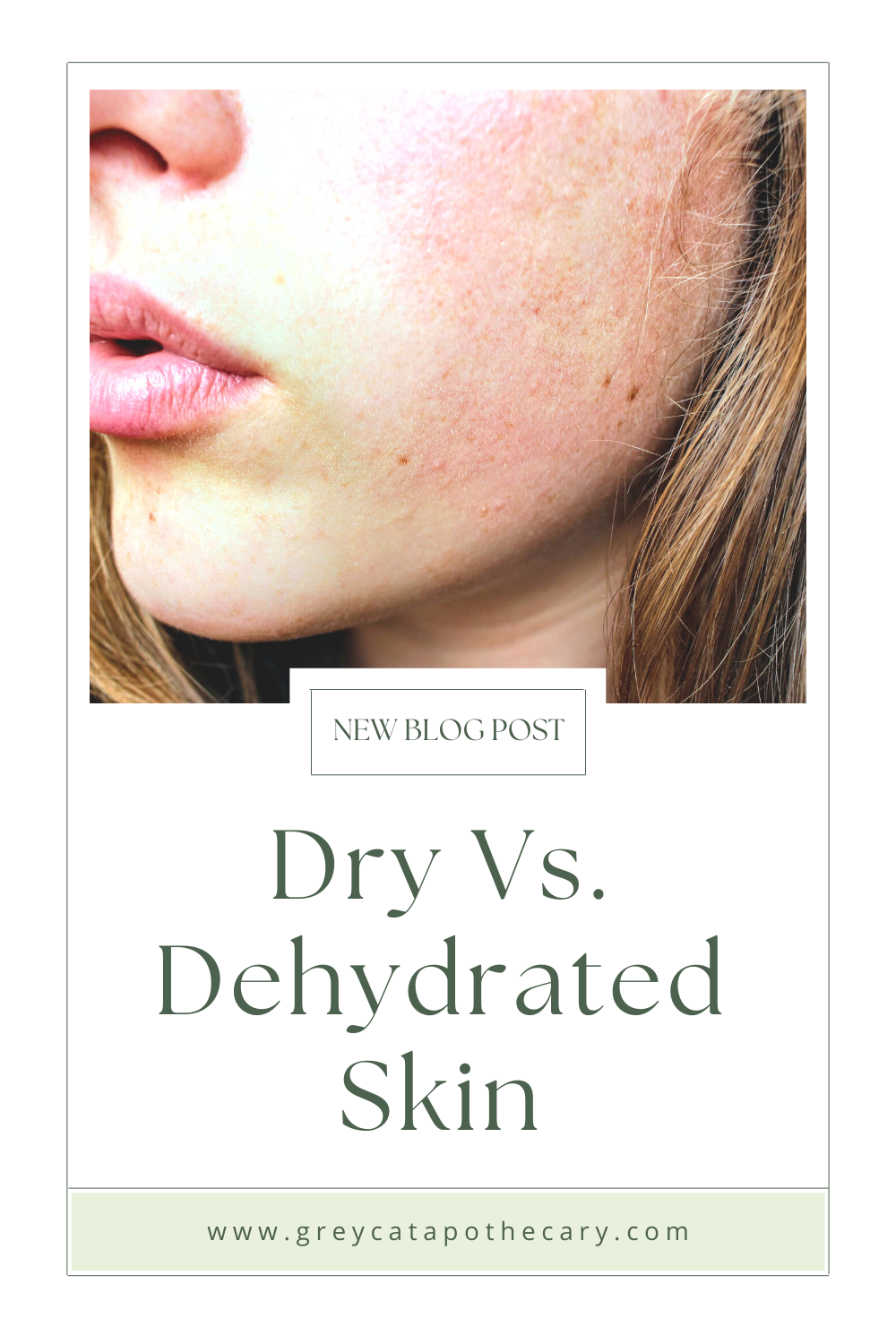 Dry Skin Blog Post