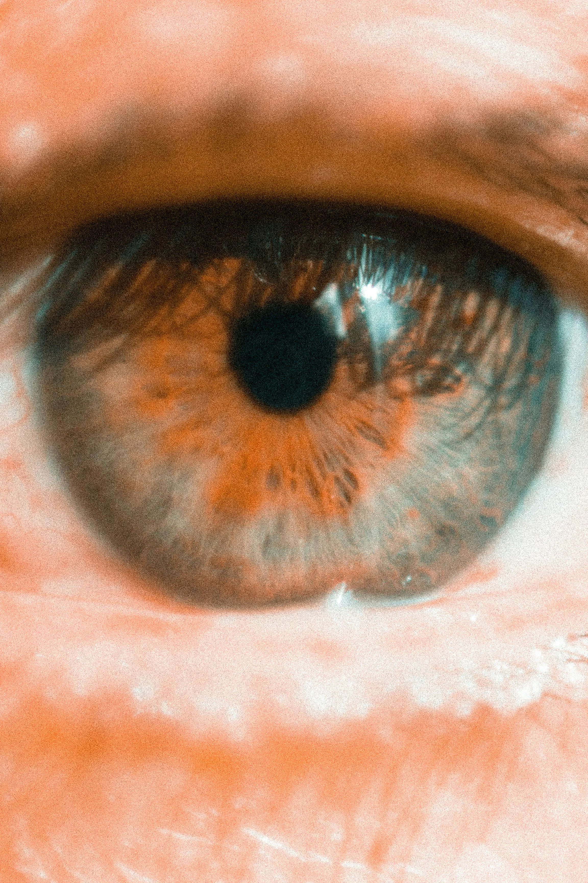 Glaucoma Awareness Month