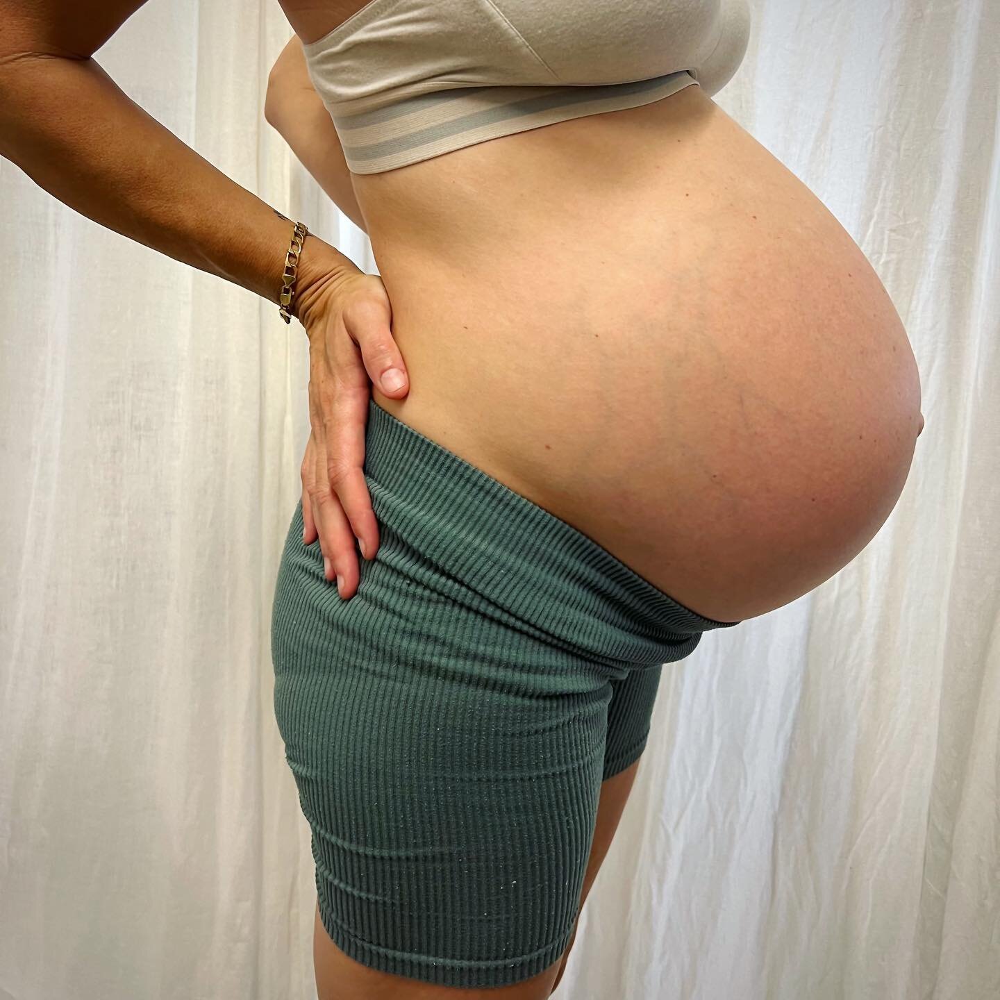 ~ A CASE STUDY: Chinese Herbal Medicine and Acupuncture for Abdominal Pain in Third Trimester ~

It's very exciting to share this case study since abdominal pain in pregnancy is fairly common and little is on offer from conventional medicine to help 