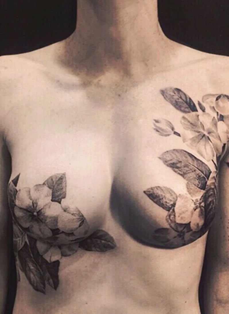 Acupuncture and Breast Cancer: Easing Hot Flashes and Improving Quality of Life