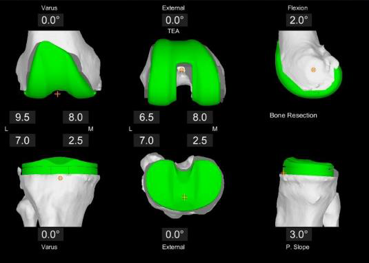 Urgent Orthopedic Specialists