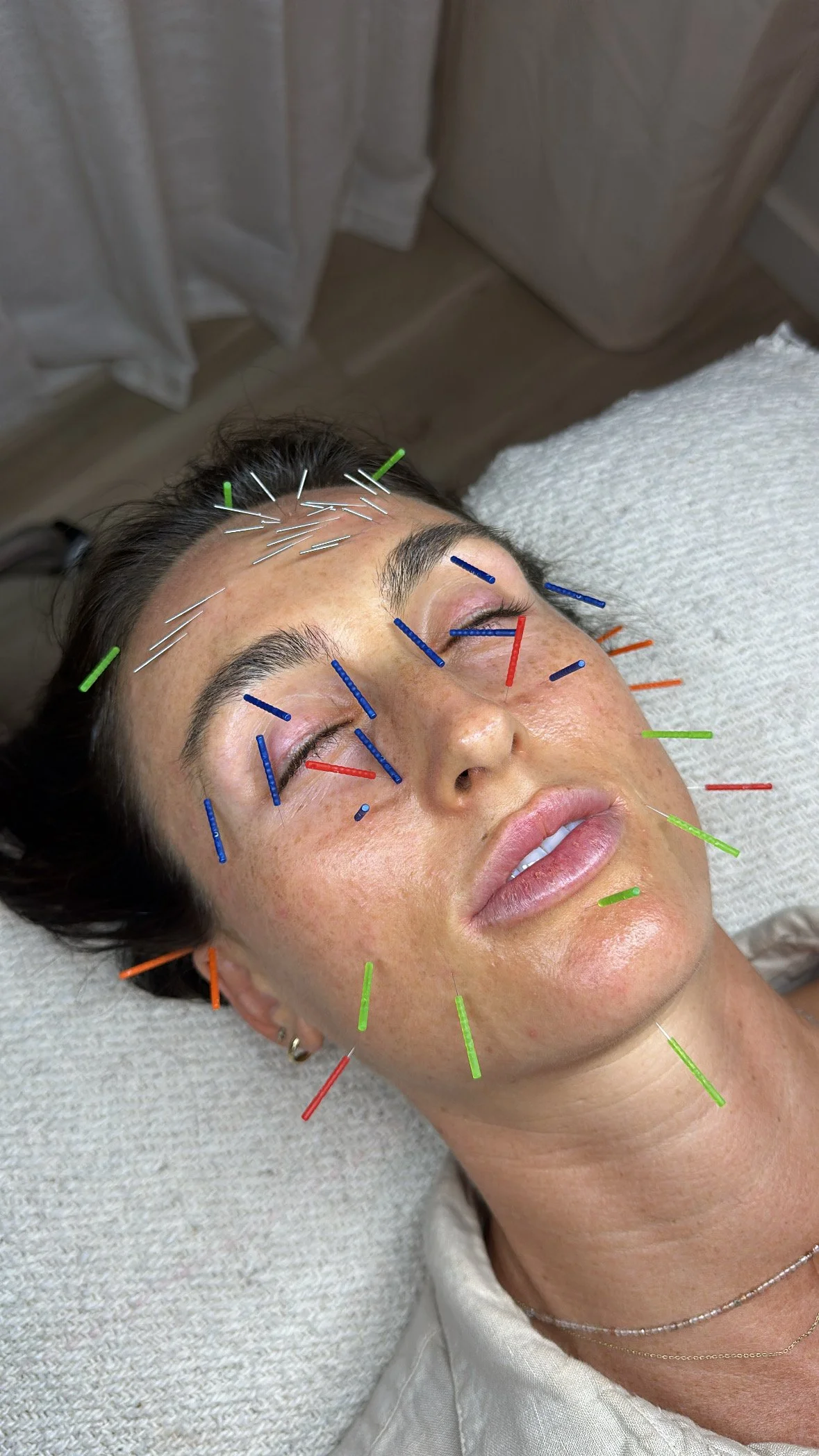 What Chinese Medicine Teaches Us About Aging Gracefully: Cosmetic Acupuncture, Qigong, &amp; Redefining What “Healthy” Means