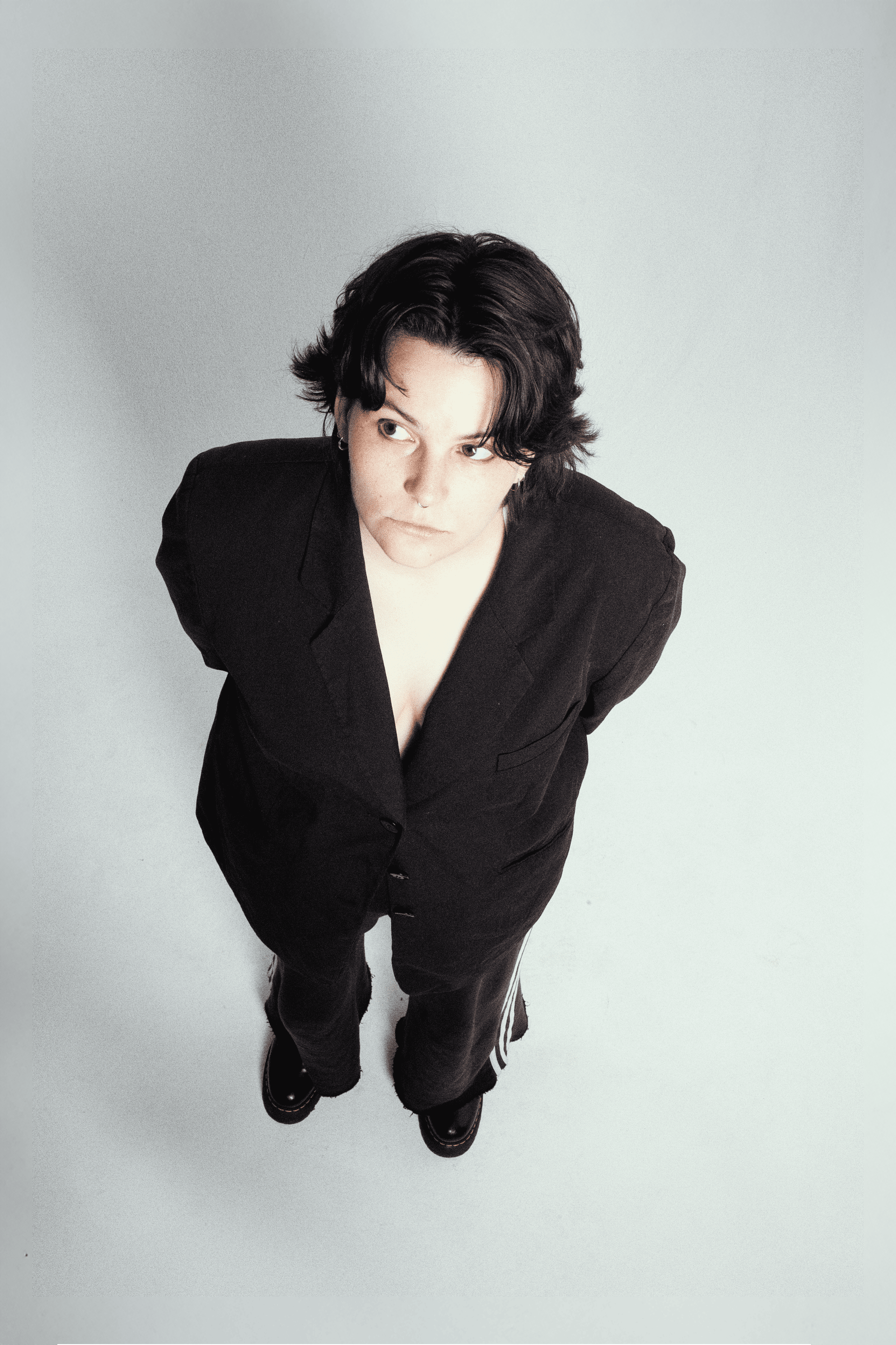 Surprise am Mittag - Verbrennung 3. Grades