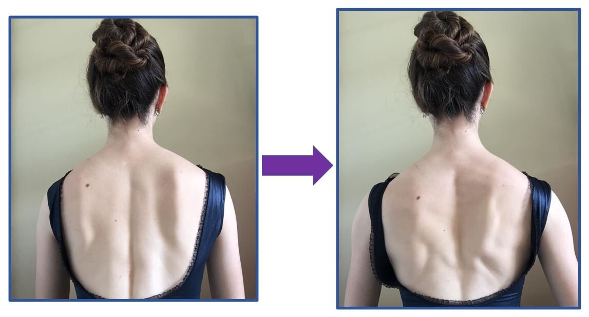 Shoulder Blade Placement Pro Tip from Elizabeth Marlin — School of Ballet 58