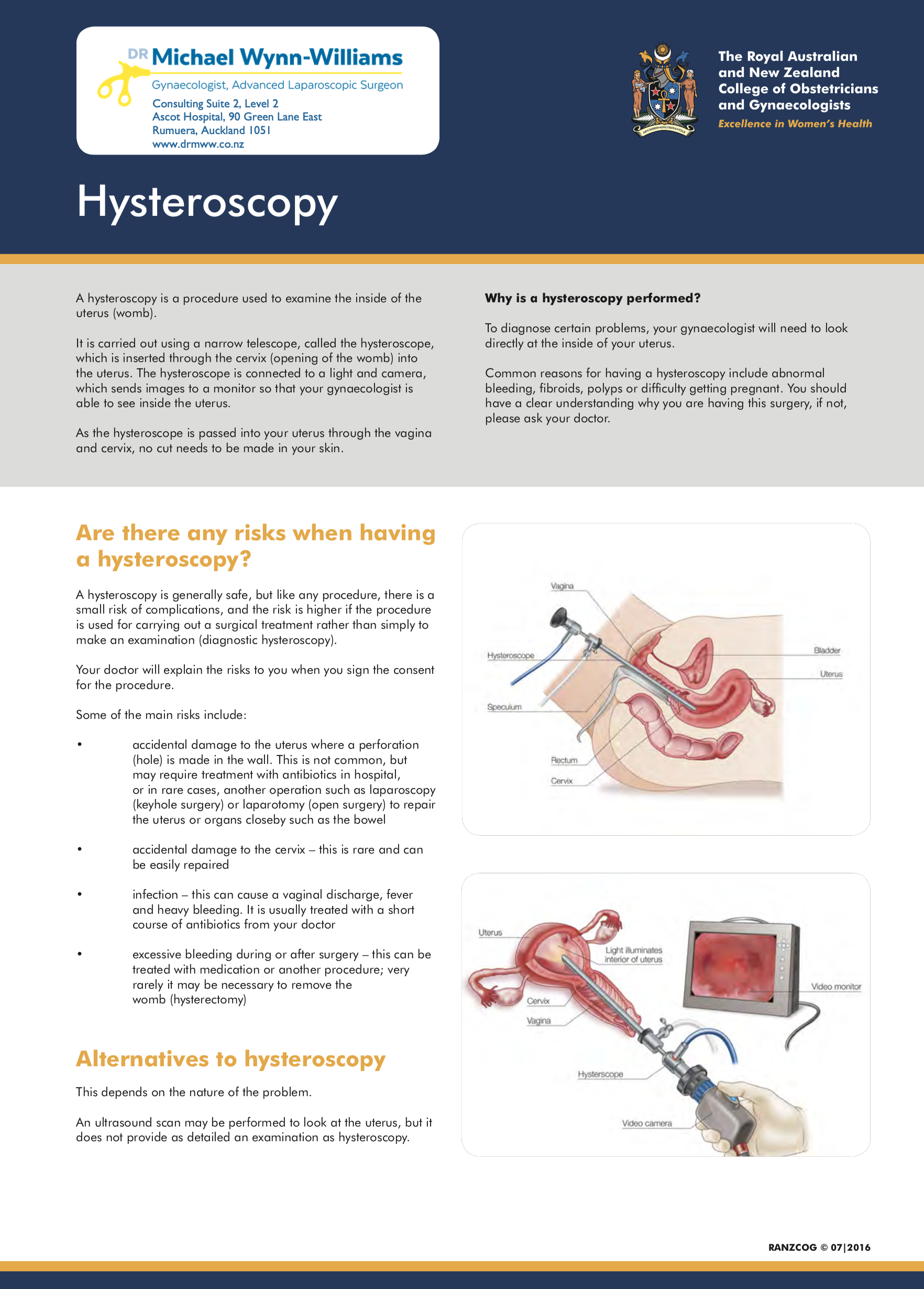 Hysteroscopy.png