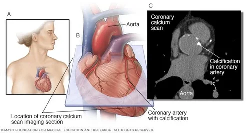 Normal Heart Scan Noninvasive Imaging Centers across the US — Precision Health Reports