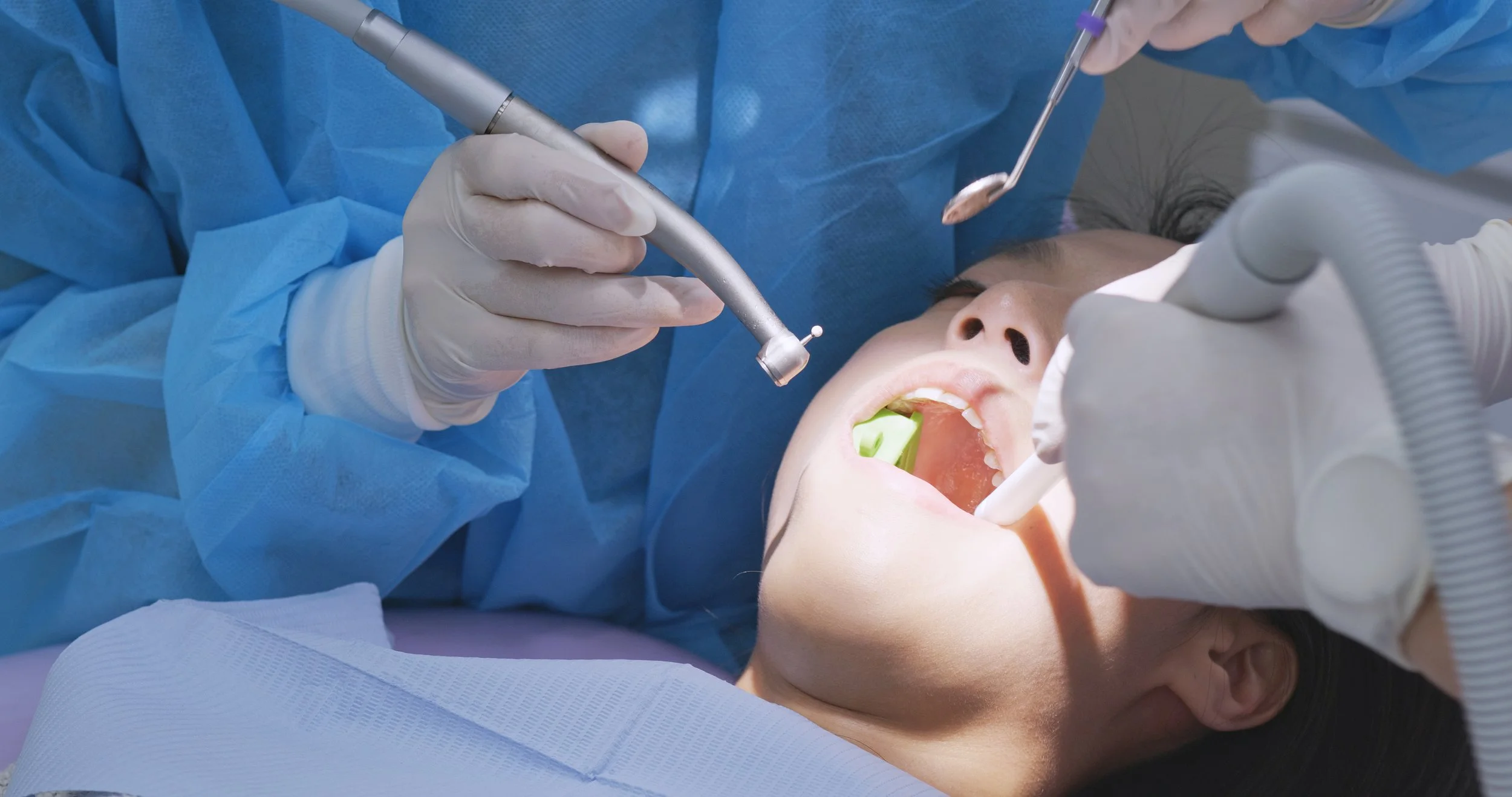 Is it Wise to Have Your Wisdom Teeth Removed?